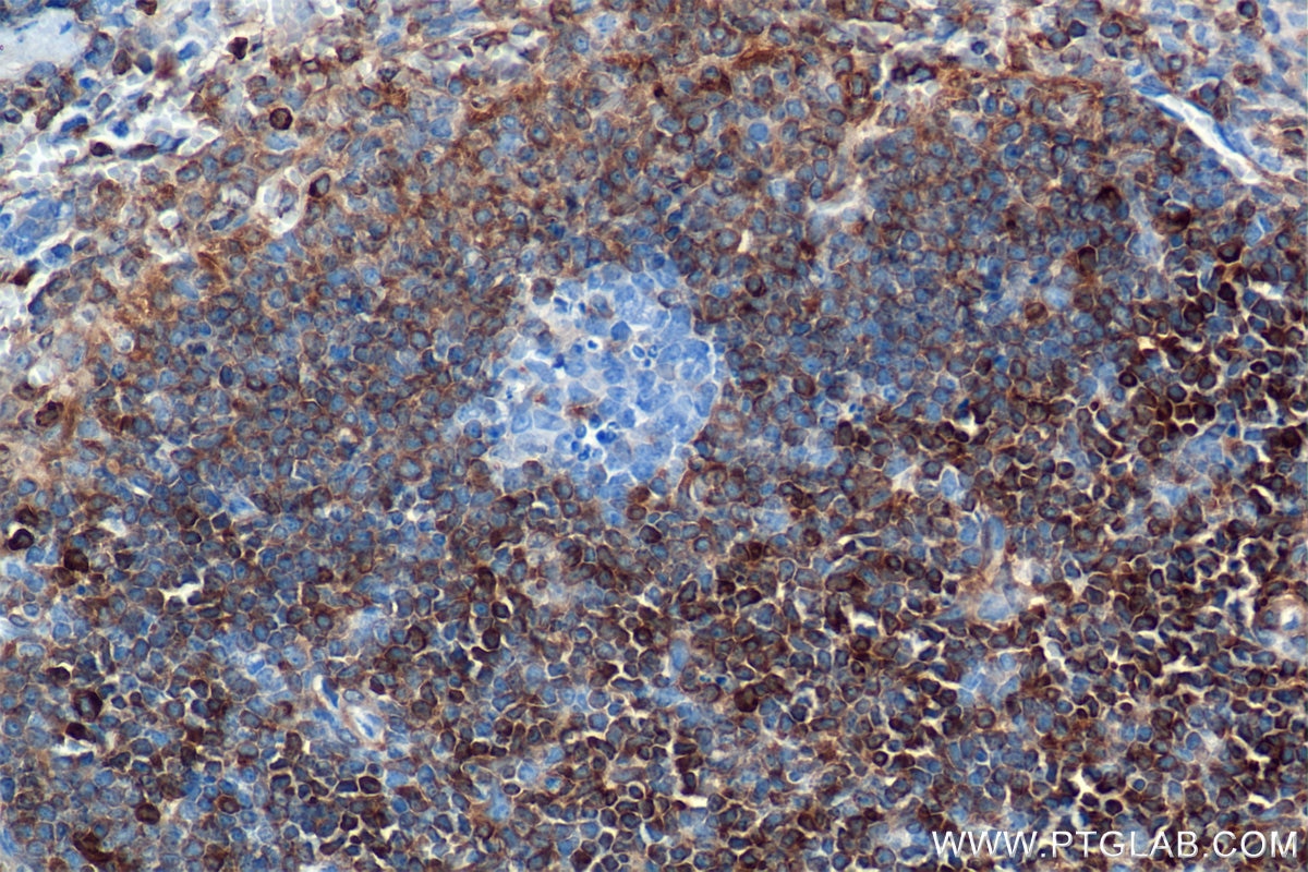Immunohistochemistry (IHC) staining of mouse spleen tissue using Bcl2 Recombinant antibody (82469-6-RR)