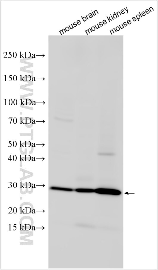 Western Blot (WB) analysis of various lysates using Bcl2 Recombinant antibody (82469-6-RR)