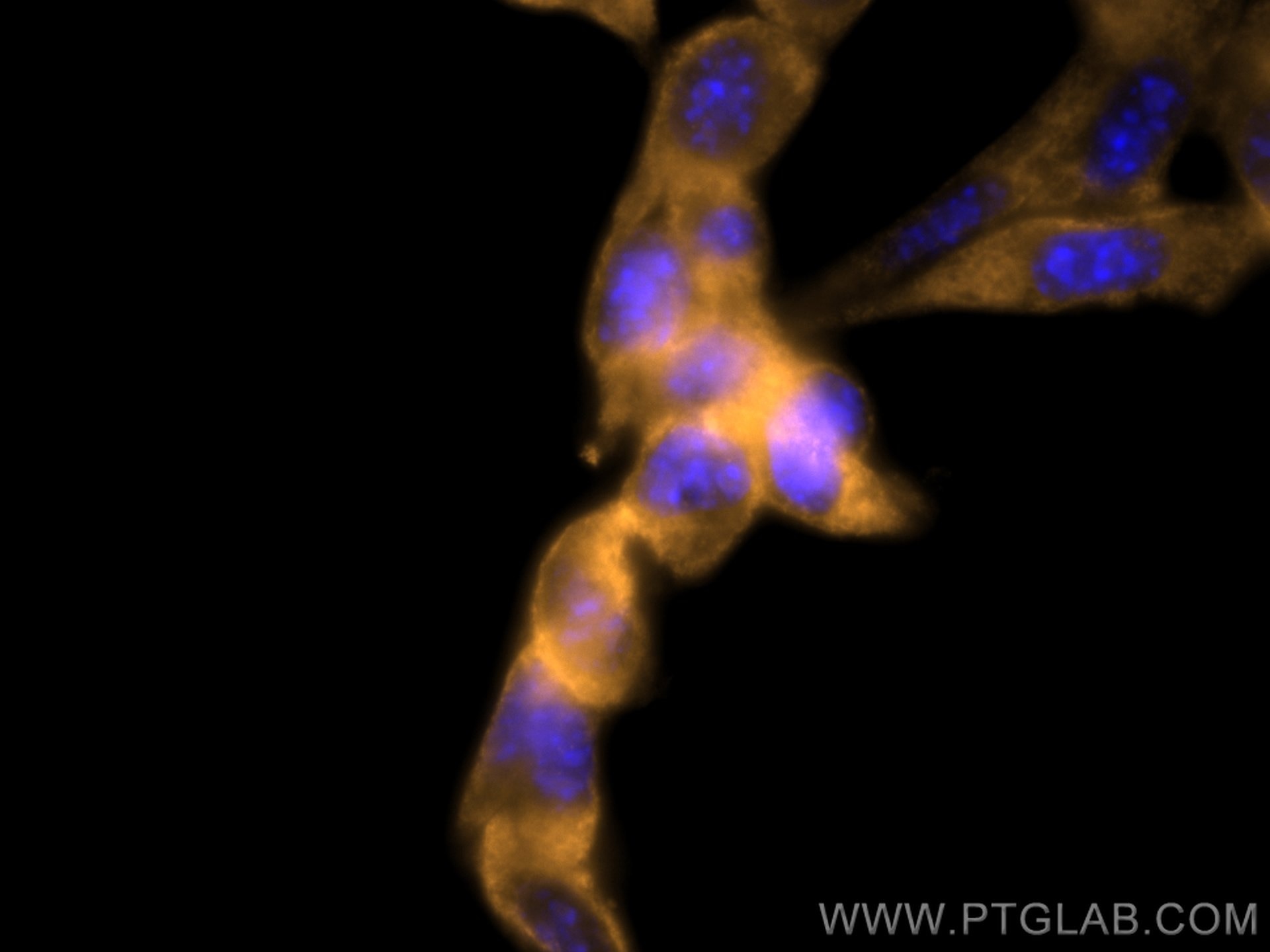Immunofluorescence (IF) / fluorescent staining of NIH/3T3 cells using CoraLite®555-conjugated Bcl2 Monoclonal antibody (CL555-66799)