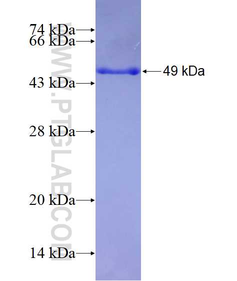 Bcl2 fusion protein Ag24260 SDS-PAGE