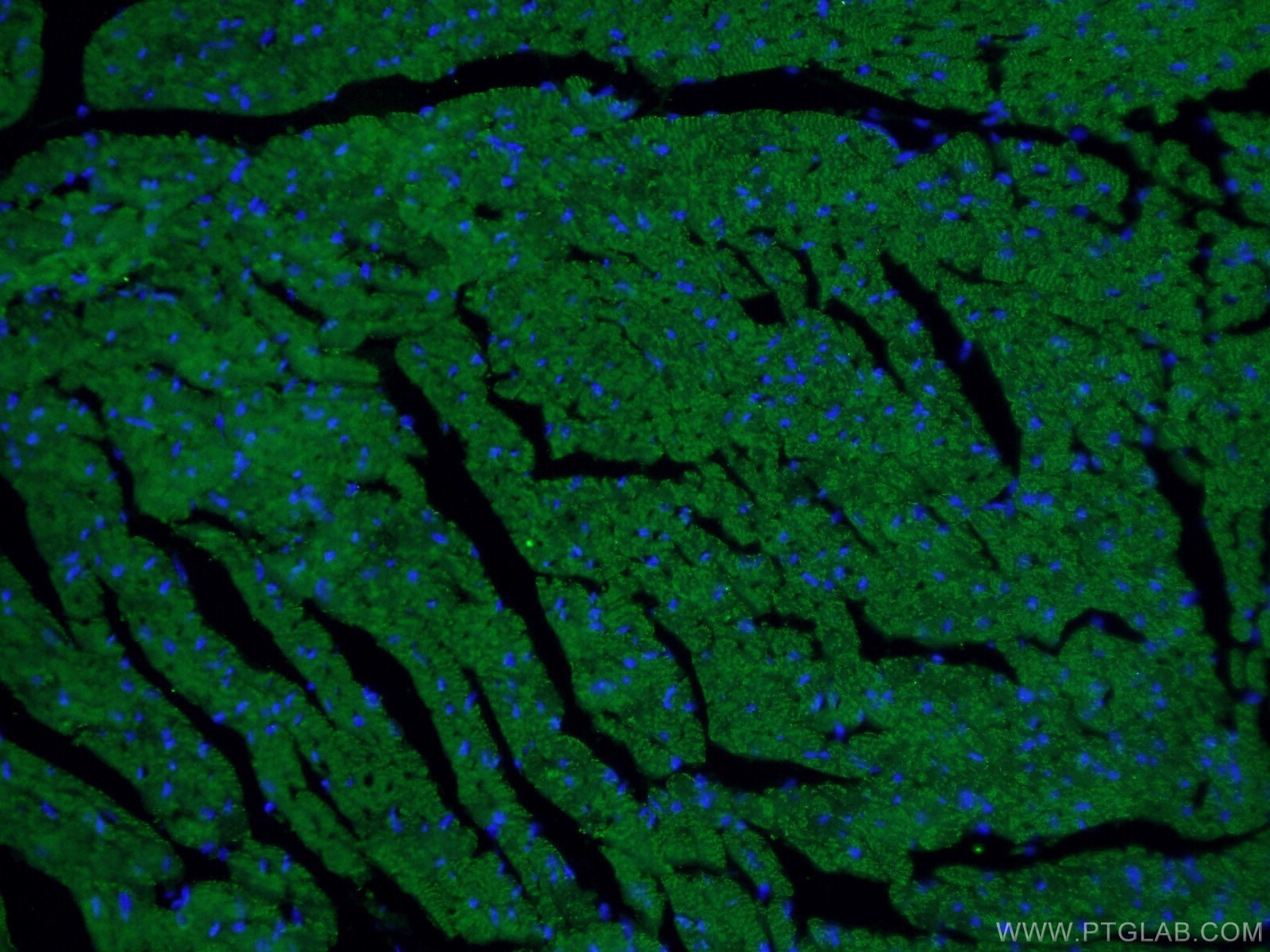 Immunofluorescence (IF) / fluorescent staining of mouse heart tissue using Beclin 1 Monoclonal antibody (66665-1-Ig)