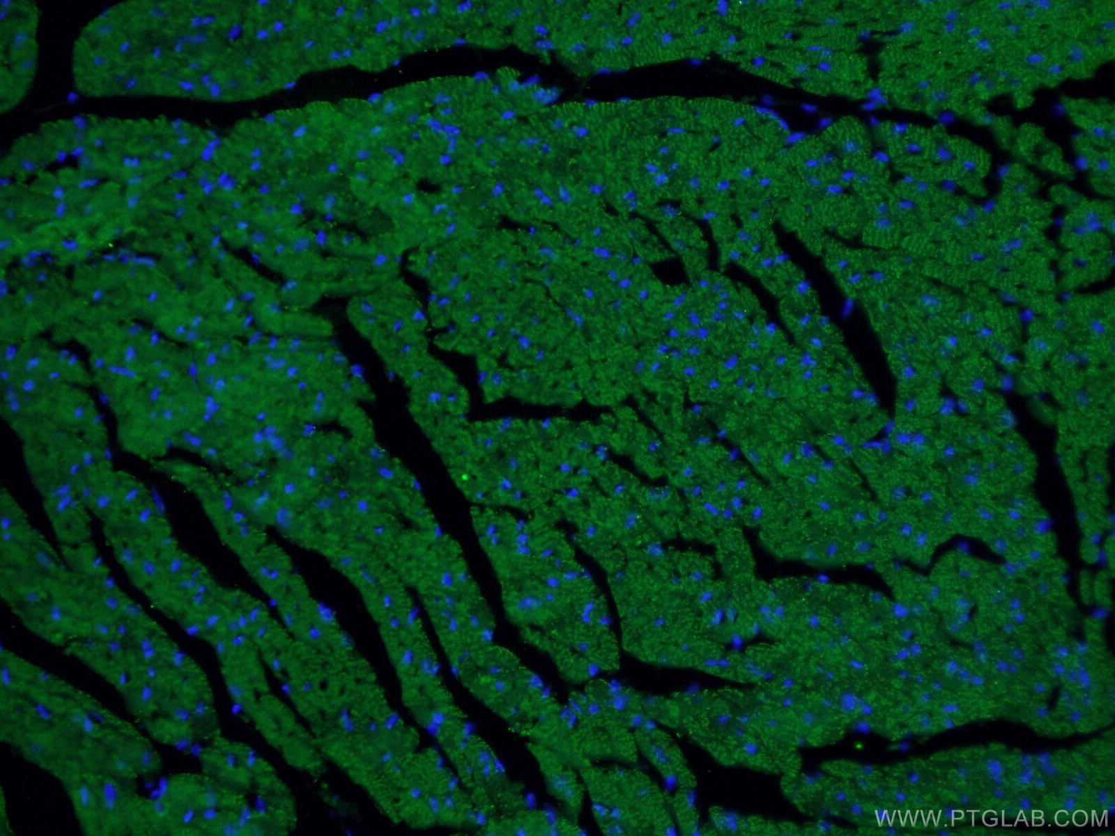 IF Staining of mouse heart using 66665-1-Ig