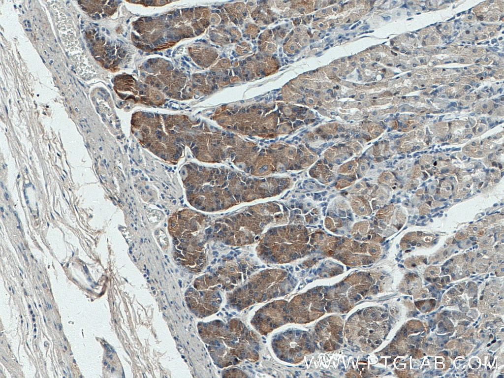 Immunohistochemistry (IHC) staining of human stomach tissue using Beclin 1 Monoclonal antibody (66665-1-Ig)