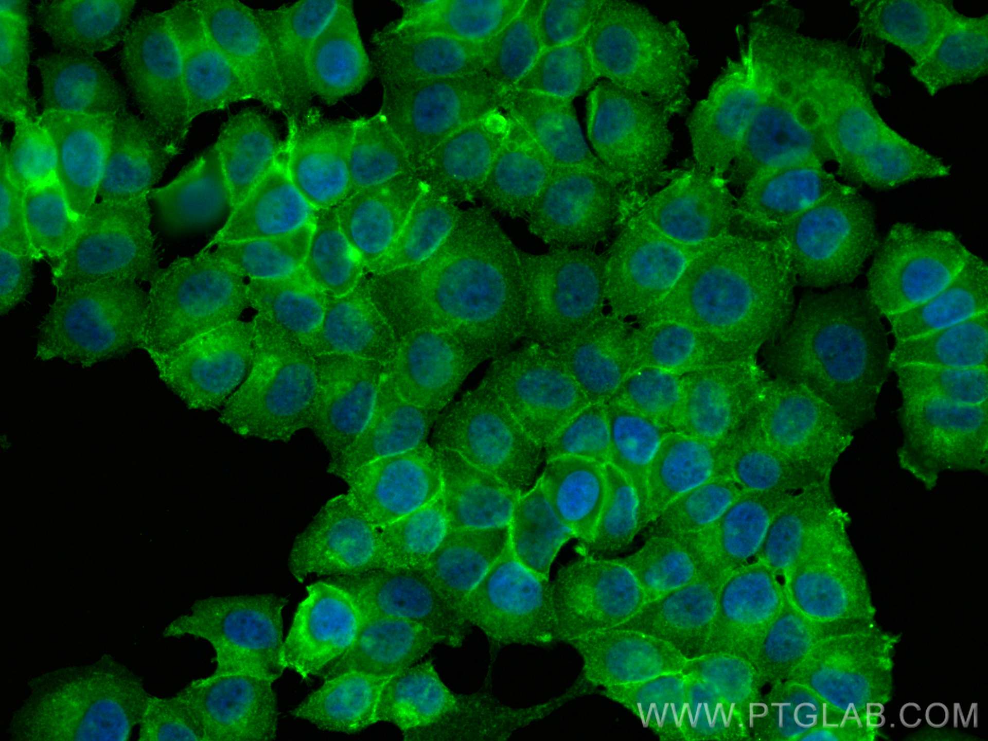 Immunofluorescence (IF) / fluorescent staining of NCCIT cells using Beta-2-Microglobulin Polyclonal antibody (30226-1-AP)