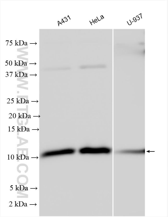 Western Blot (WB) analysis of various lysates using Beta-2-Microglobulin Polyclonal antibody (30226-1-AP)