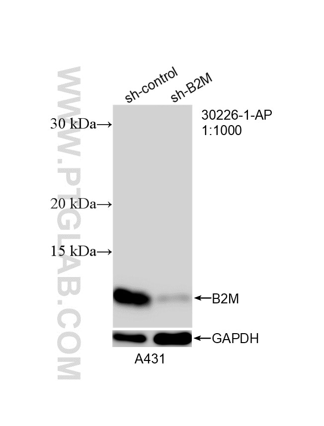 Western Blot (WB) analysis of A431 cells using Beta-2-Microglobulin Polyclonal antibody (30226-1-AP)