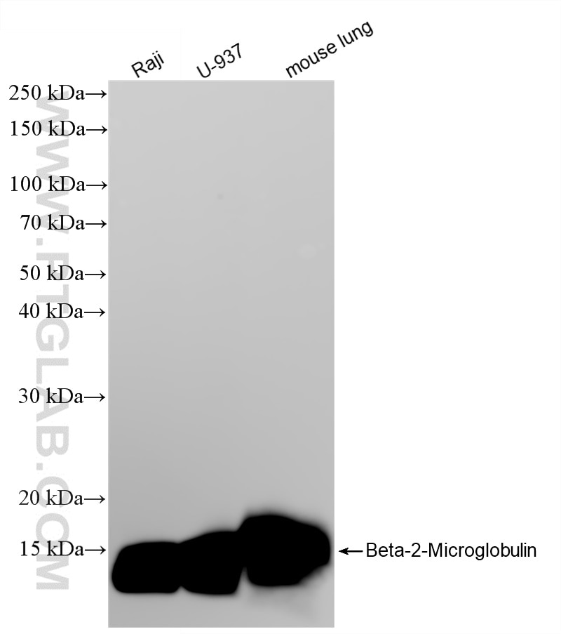WB analysis using 83683-6-RR Western Blot (WB) analysis of various lysates using Beta-2-Microglobulin Recombinant monoclonal antibo (83683-6-RR)