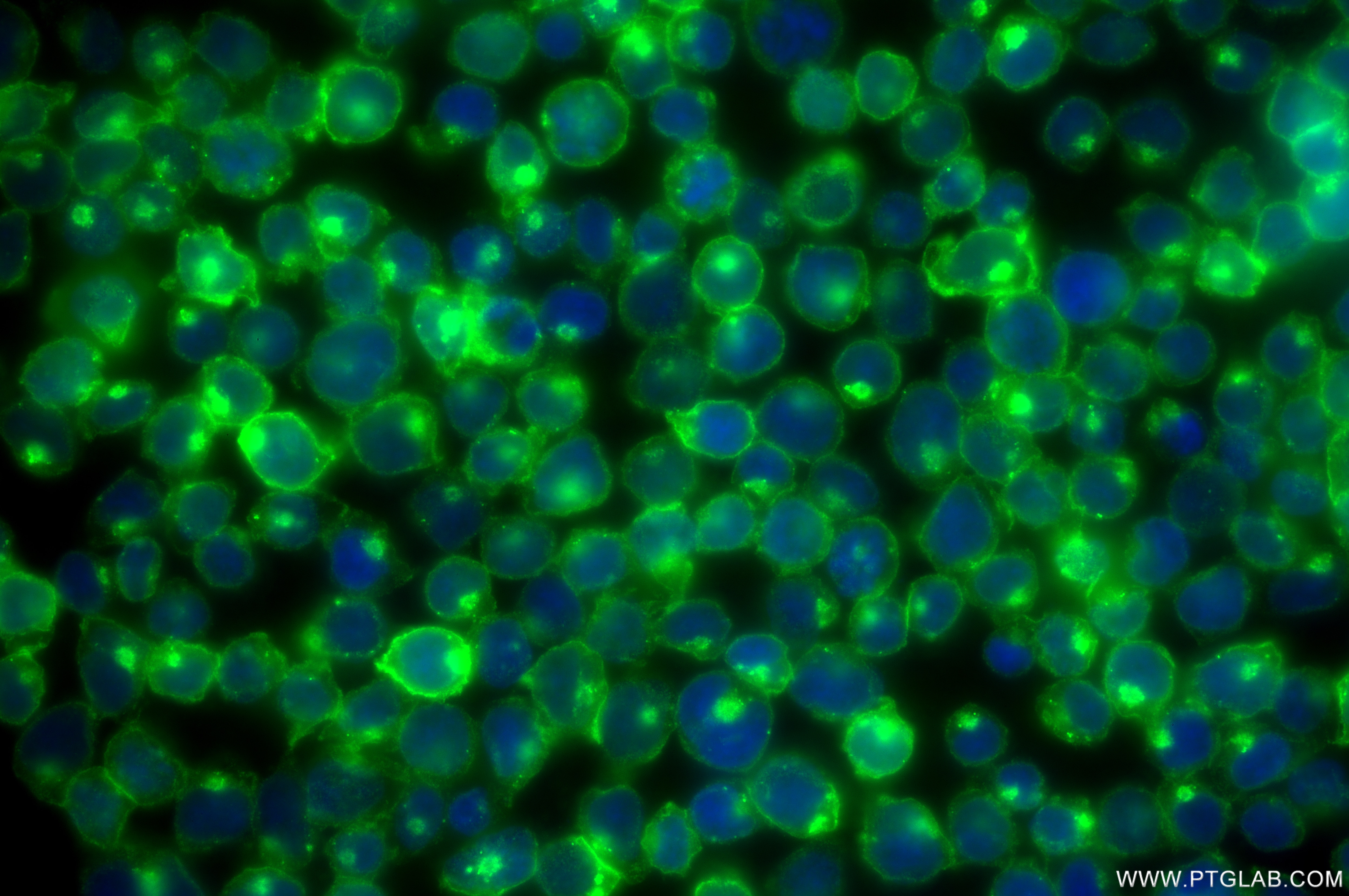 Immunofluorescence (IF) / fluorescent staining of Jurkat cells using Beta-2-Microglobulin Recombinant antibody (83683-8-RR)