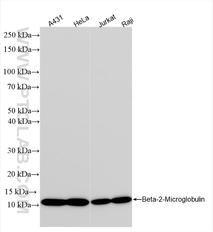 Western Blot (WB) analysis of various lysates using Beta-2-Microglobulin Recombinant antibody (83683-8-RR)