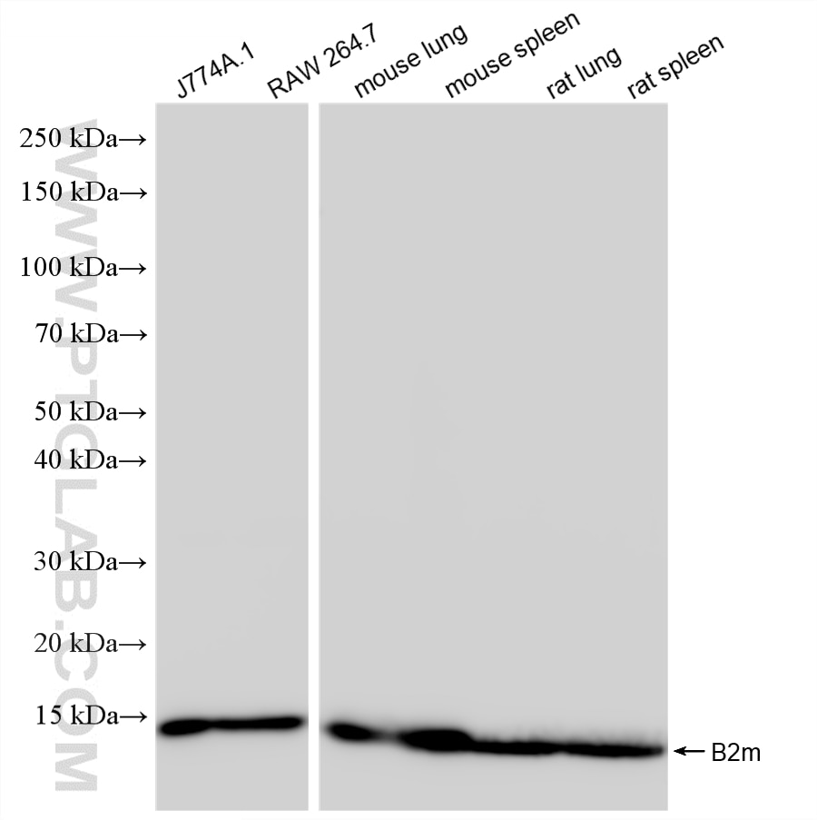 Western Blot (WB) analysis of various lysates using Beta-2-Microglobulin Recombinant monoclonal antibo (85871-4-RR)
