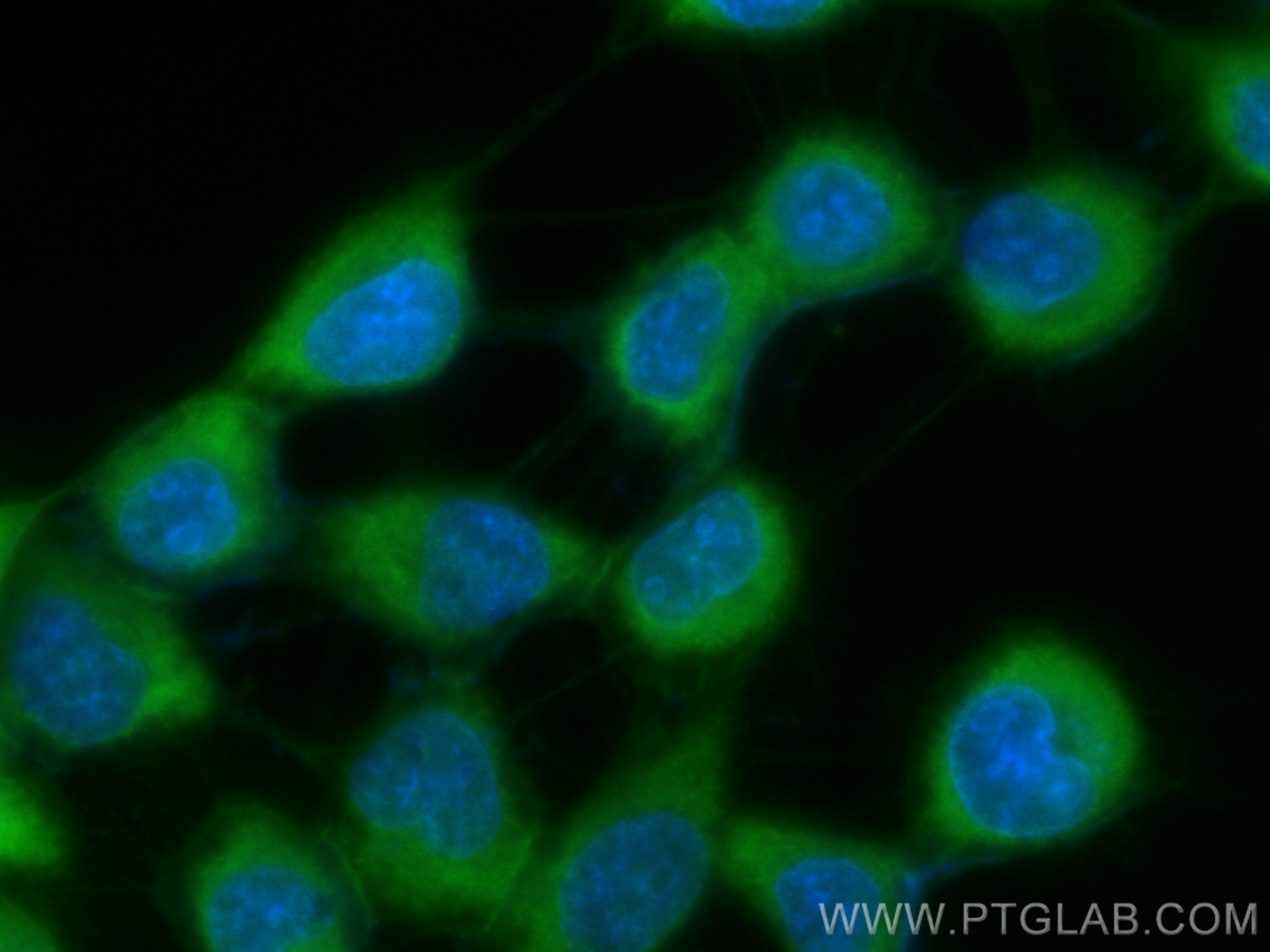 Immunofluorescence (IF) / fluorescent staining of A431 cells using CoraLite® Plus 488-conjugated Beta-2-Microglobulin (CL488-13511)