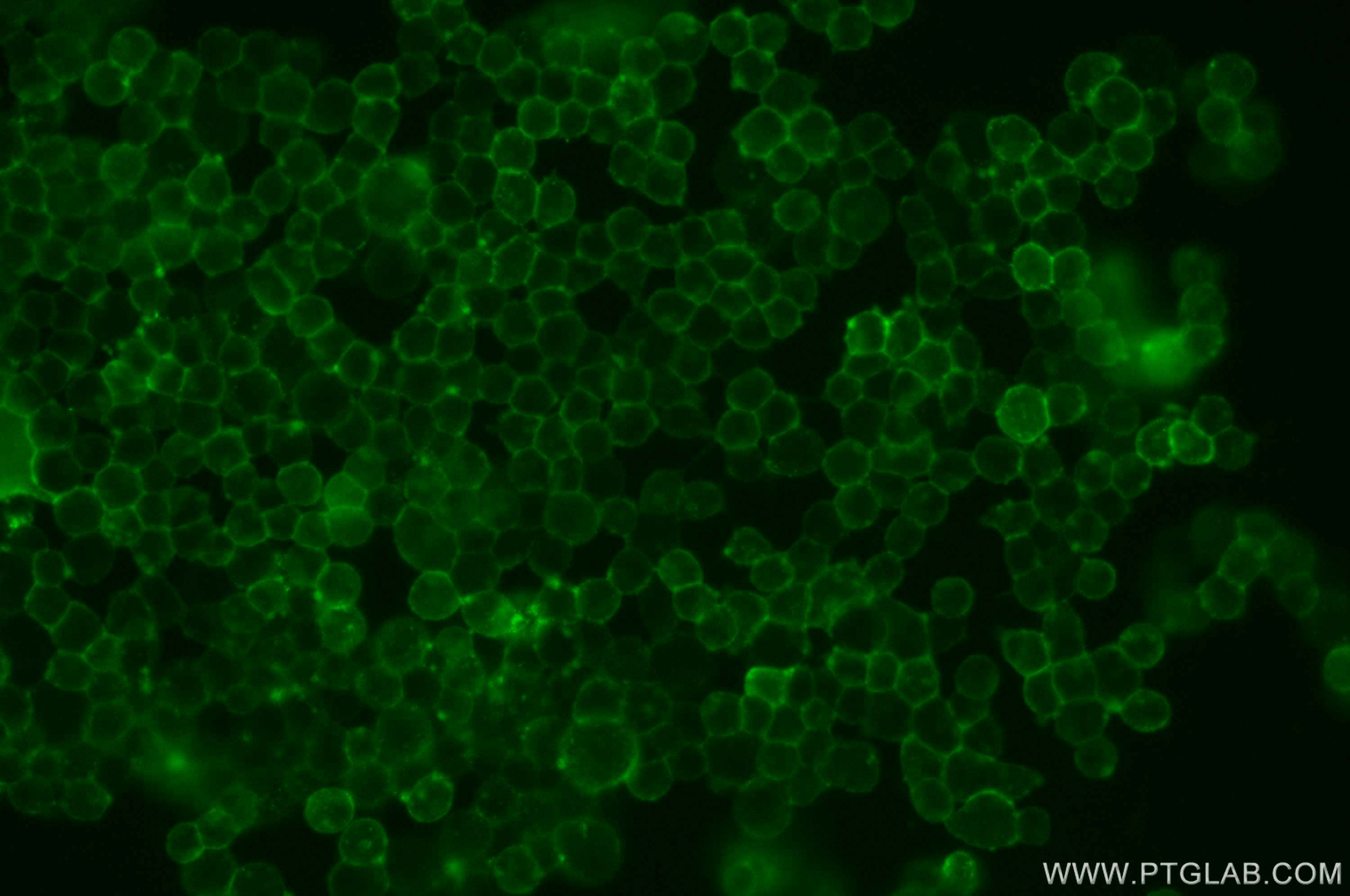 Immunofluorescence (IF) / fluorescent staining of NCCIT cells using CoraLite® Plus 488-conjugated Beta-2-Microglobulin (CL488-13511)