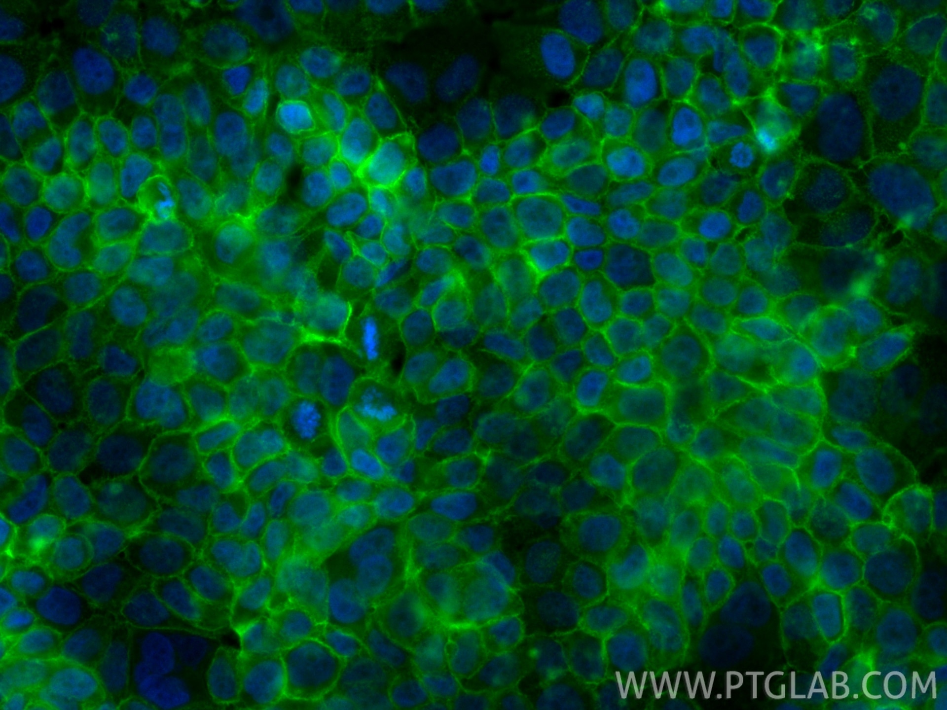 Immunofluorescence (IF) / fluorescent staining of NCCIT cells using CoraLite® Plus 488-conjugated Beta-2-Microglobulin (CL488-13511)