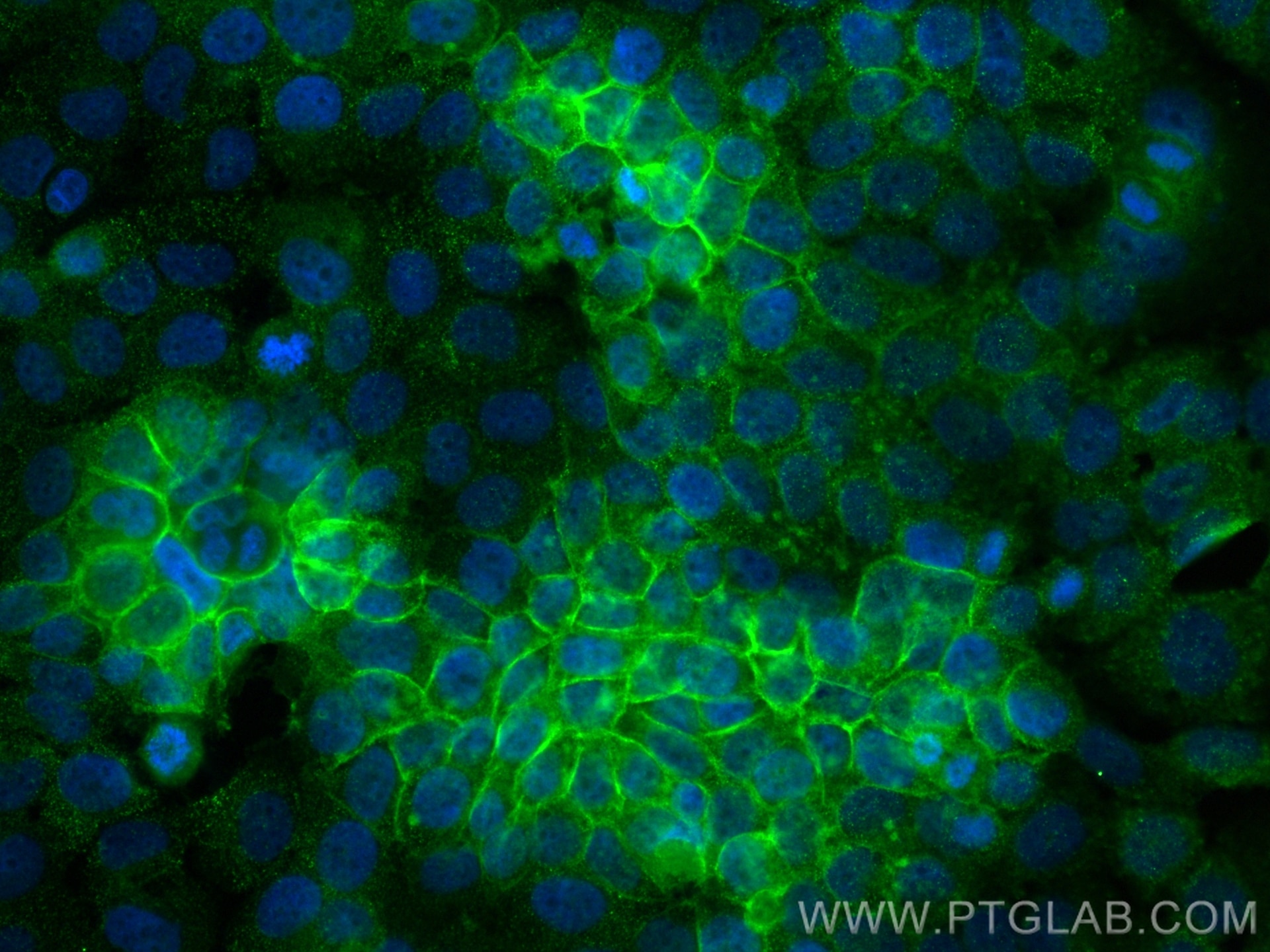 IF Staining of NCCIT using CL488-68395