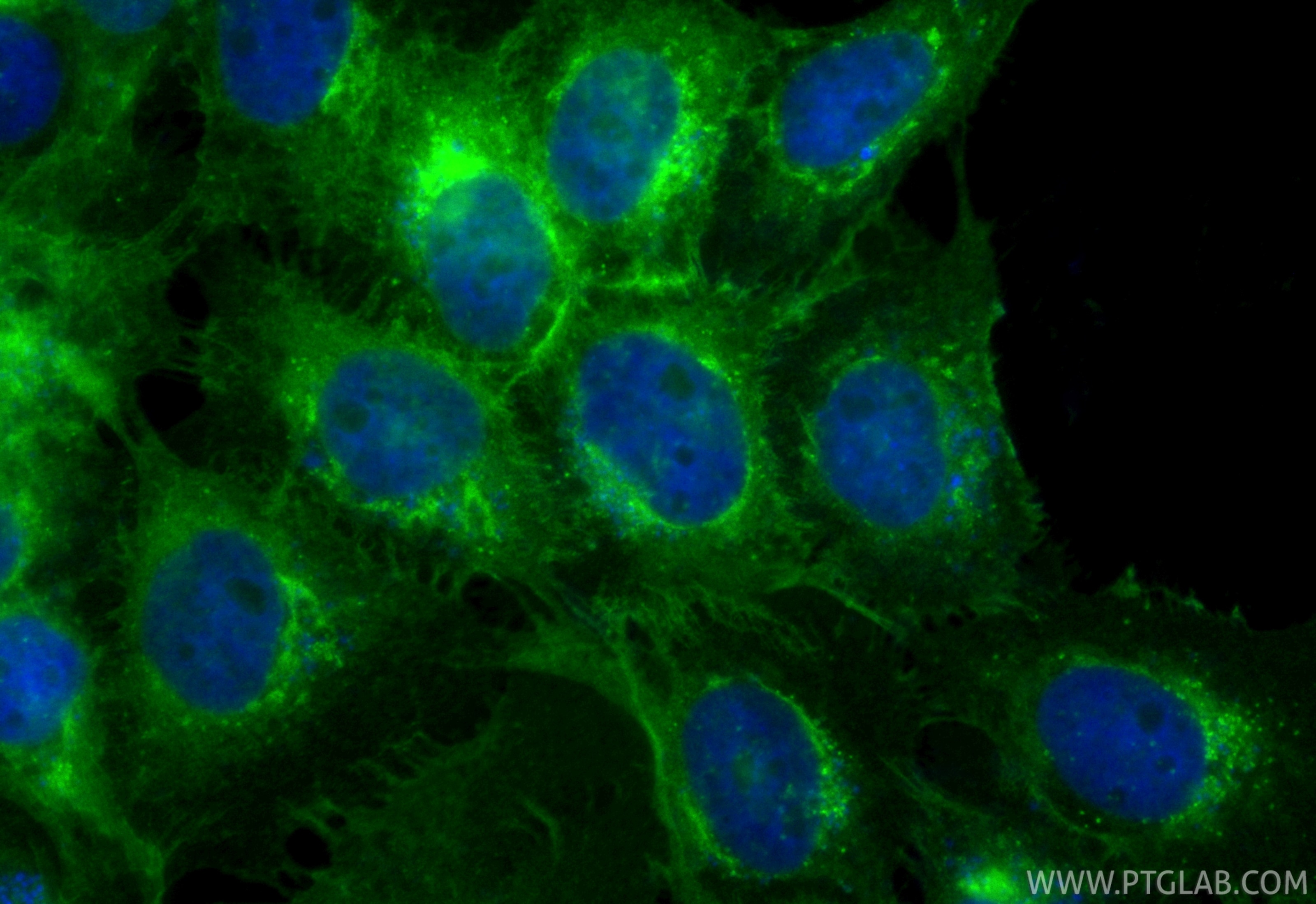 Immunofluorescence (IF) / fluorescent staining of A431 cells using CoraLite® Plus 488-conjugated Beta-2-Microglobulin (CL488-83683-8)