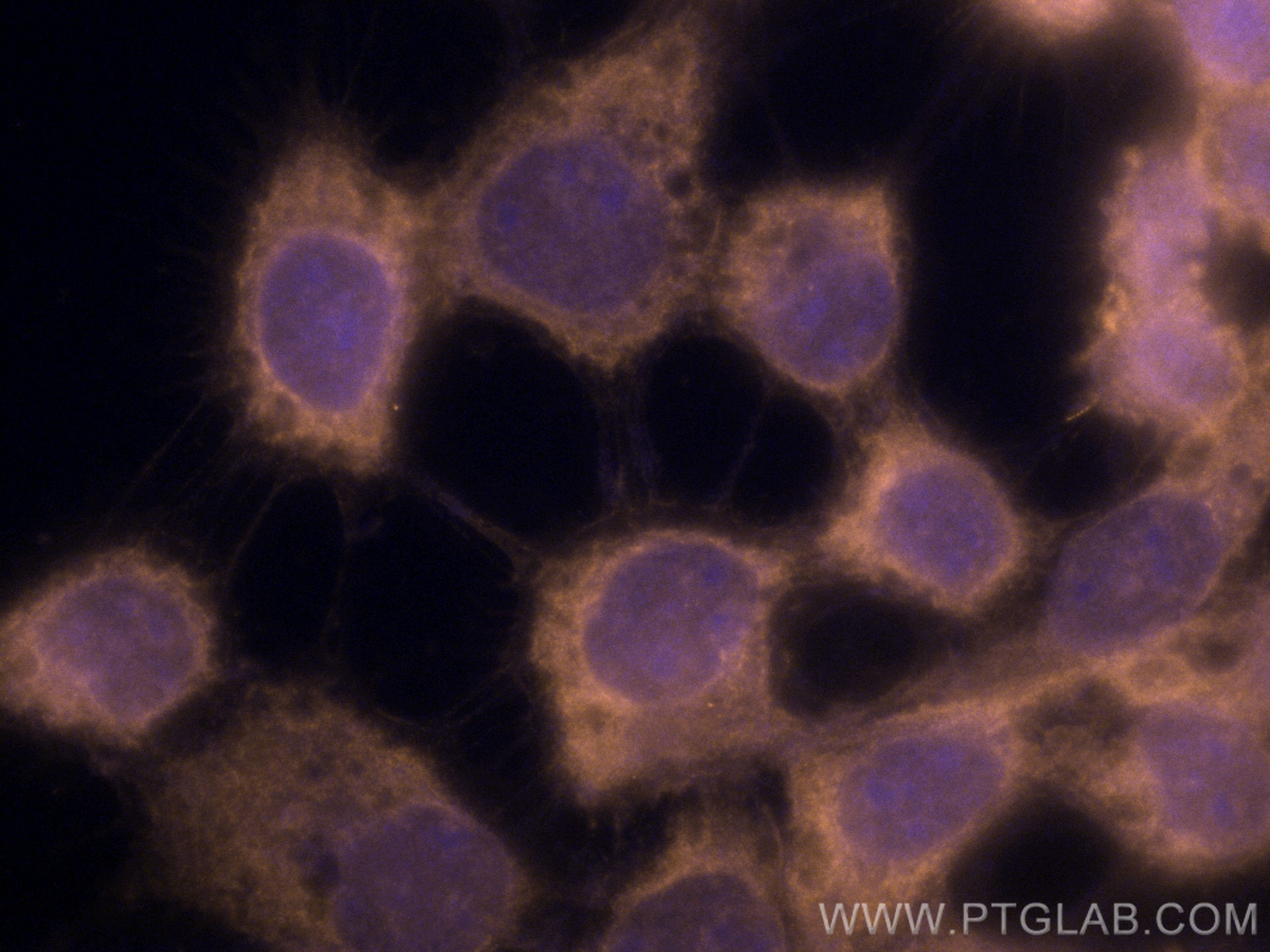 Immunofluorescence (IF) / fluorescent staining of A431 cells using CoraLite®555-conjugated Beta-2-Microglobulin Polyc (CL555-13511)