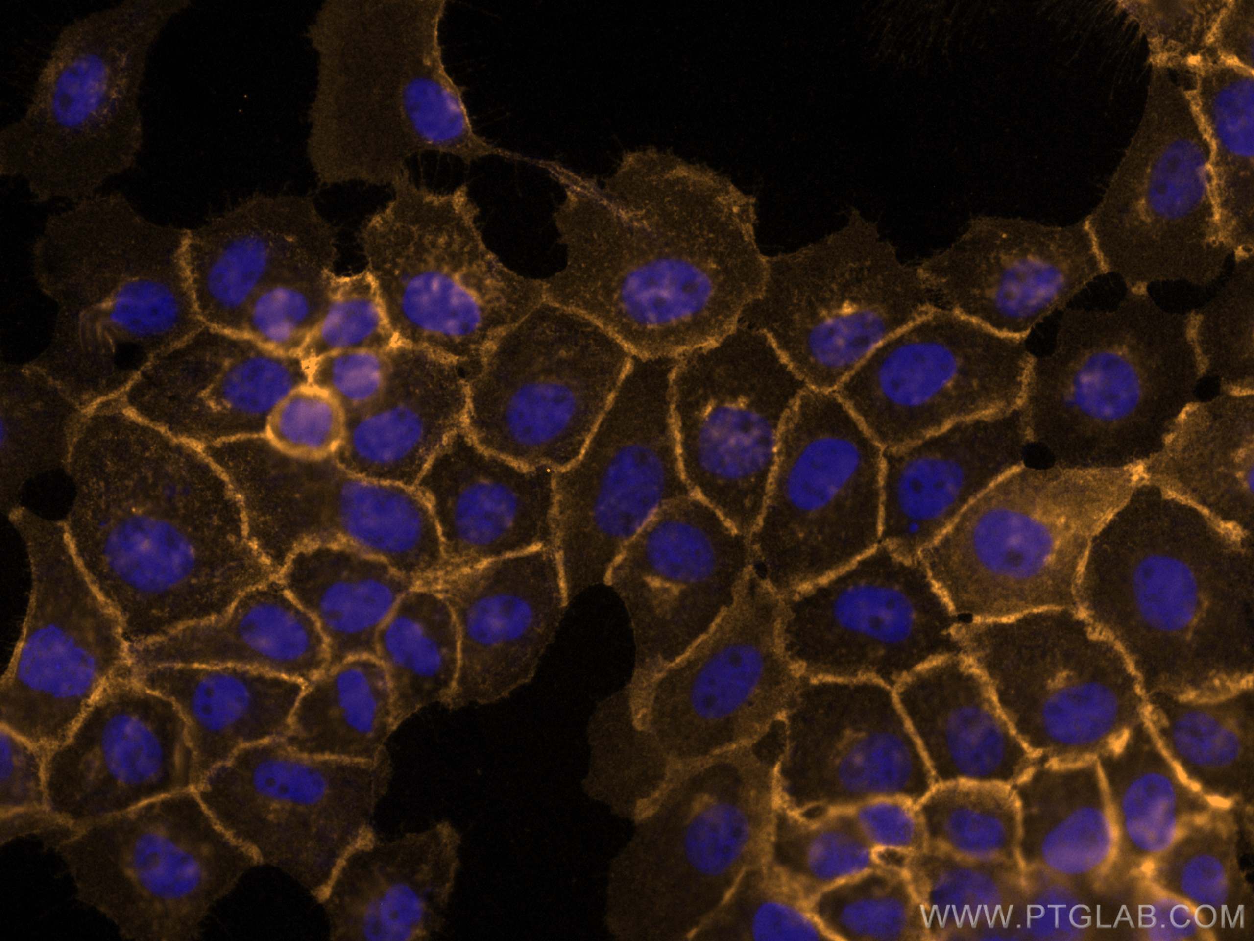 Immunofluorescence (IF) / fluorescent staining of A431 cells using CoraLite®555-conjugated Beta-2-Microglobulin Polyc (CL555-13511)