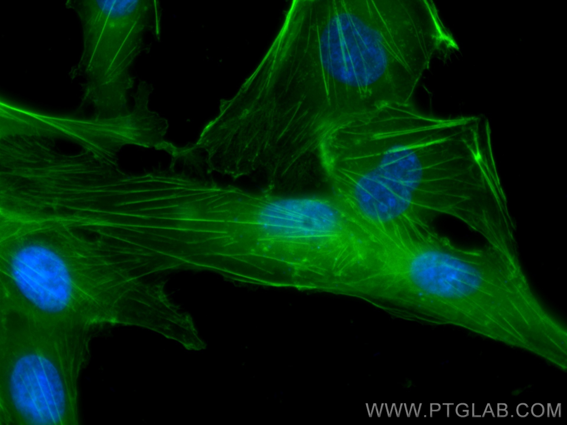 Immunofluorescence (IF) / fluorescent staining of MDCK cells using CoraLite® Plus 488-conjugated Beta Actin Recombina (CL488-81115)