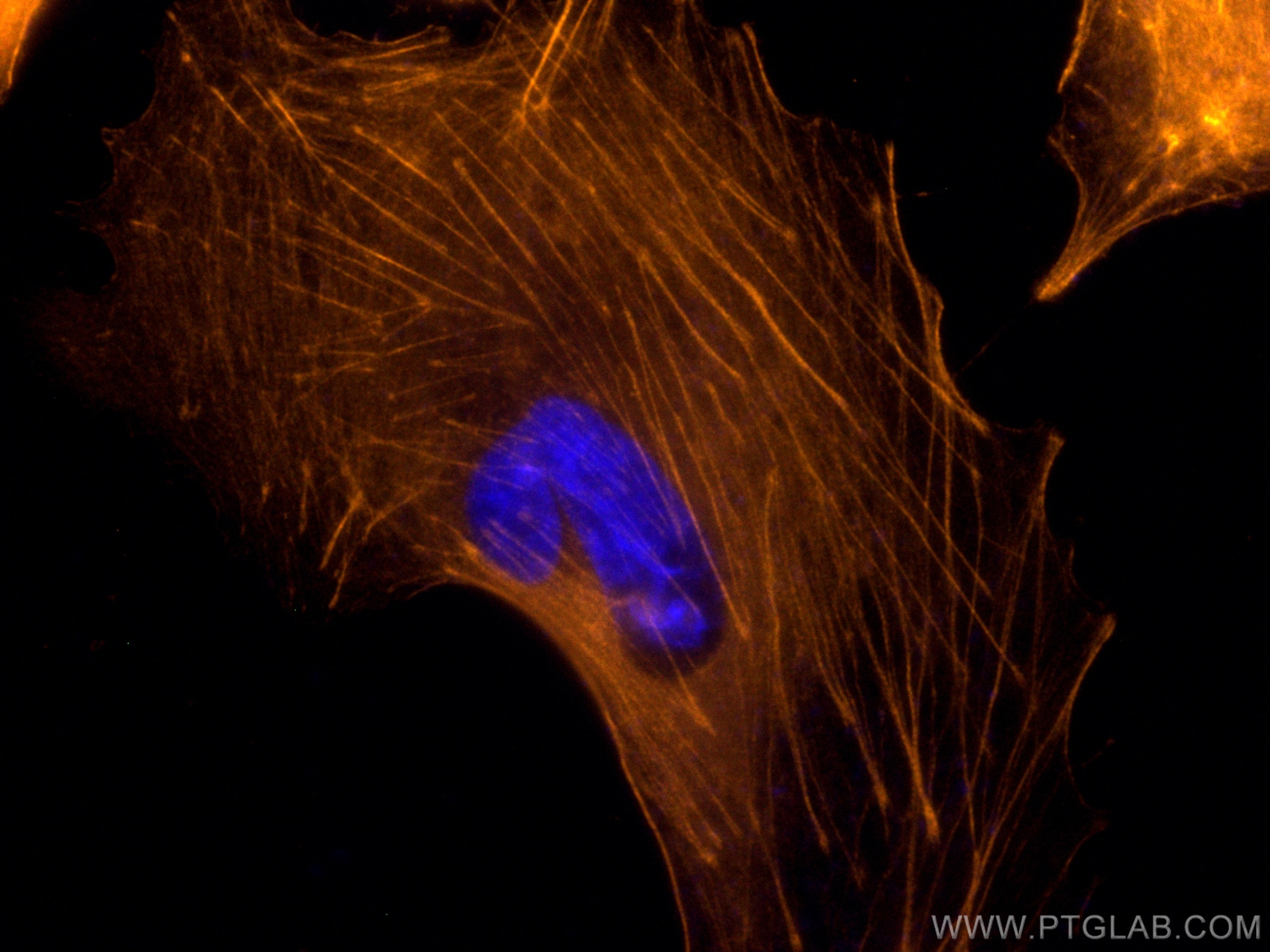 Immunofluorescence (IF) / fluorescent staining of A549 cells using CoraLite®532-conjugated Beta Actin Monoclonal anti (CL532-66009)