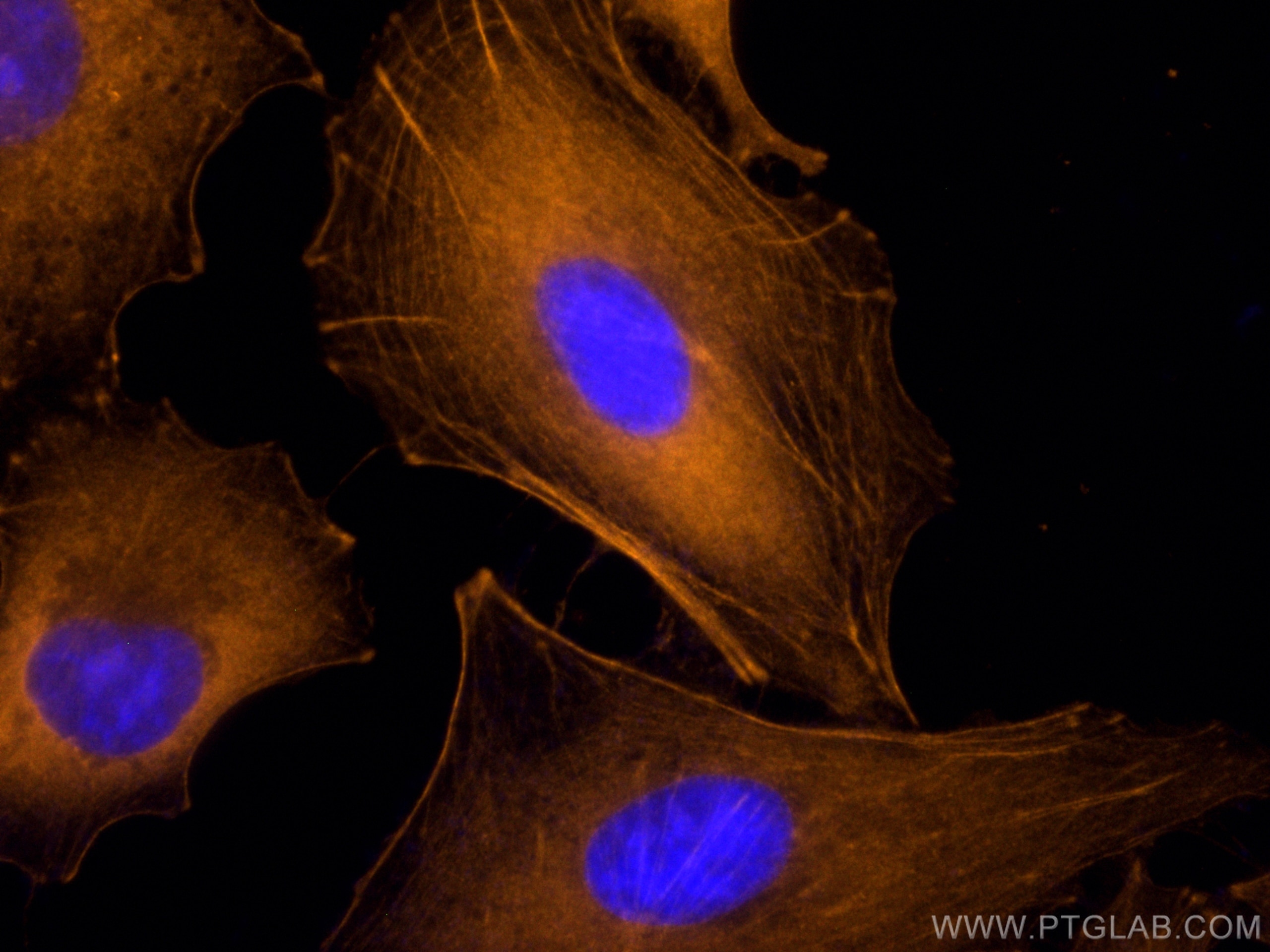 Immunofluorescence (IF) / fluorescent staining of A549 cells using CoraLite®555-conjugated Beta Actin Monoclonal anti (CL555-66009)