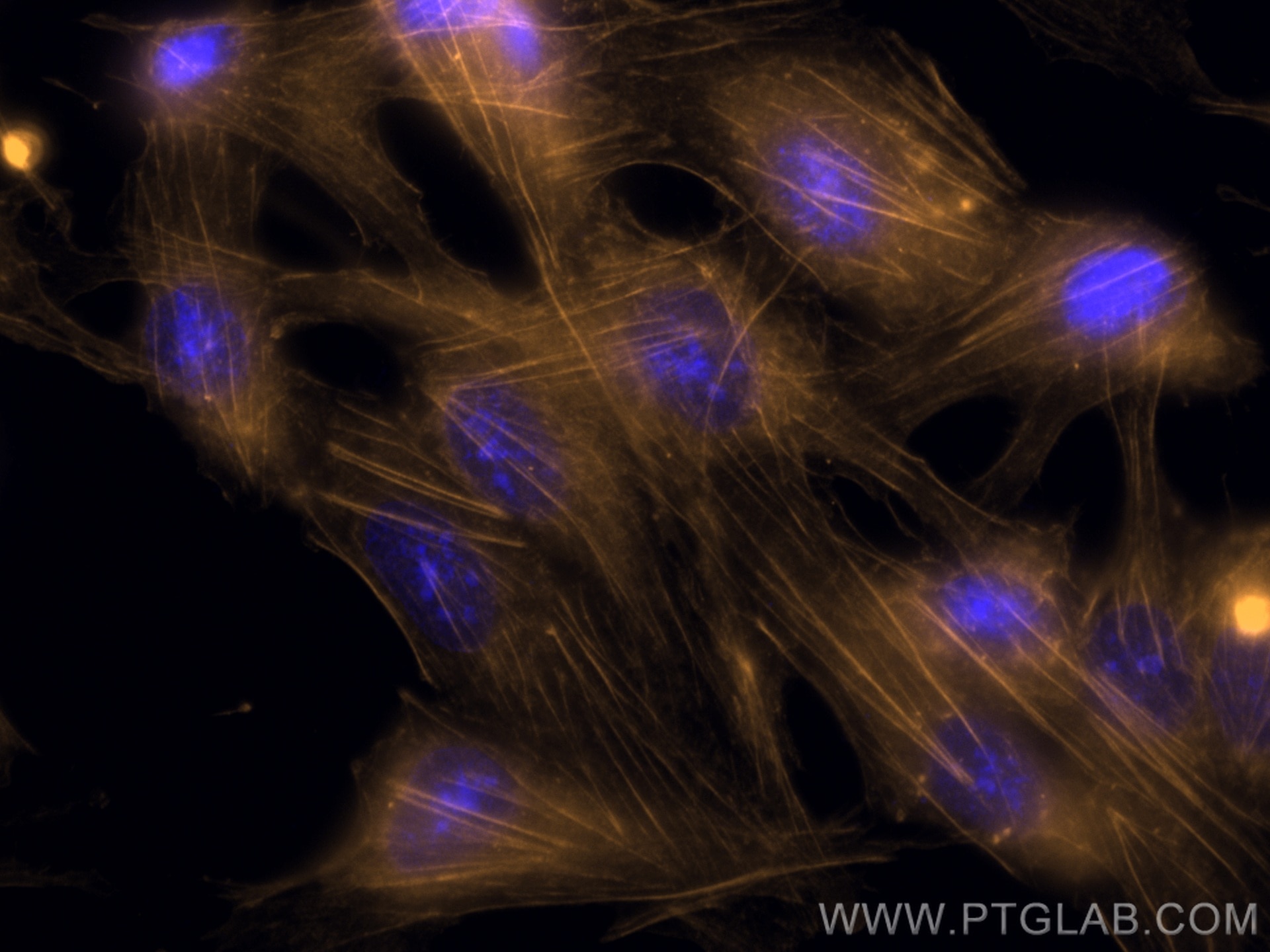 Immunofluorescence (IF) / fluorescent staining of MDCK cells using CoraLite® Plus 555-conjugated Beta Actin Recombina (CL555-81115)