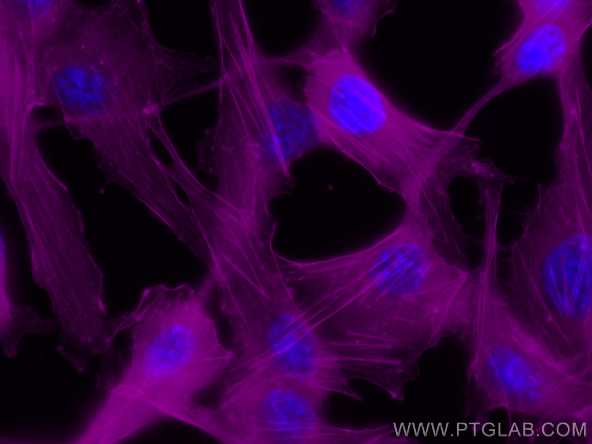 Immunofluorescence (IF) / fluorescent staining of MDCK cells using CoraLite® Plus 647-conjugated Beta Actin Recombina (CL647-81115)