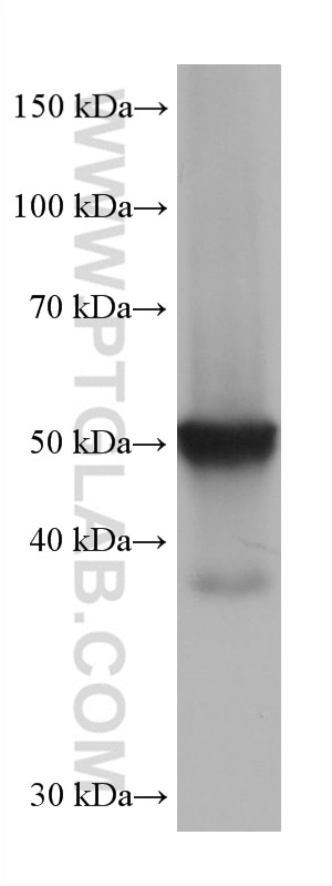 Western Blot (WB) analysis of Jurkat cells using Beta Arrestin 2 Monoclonal antibody (68502-1-Ig)