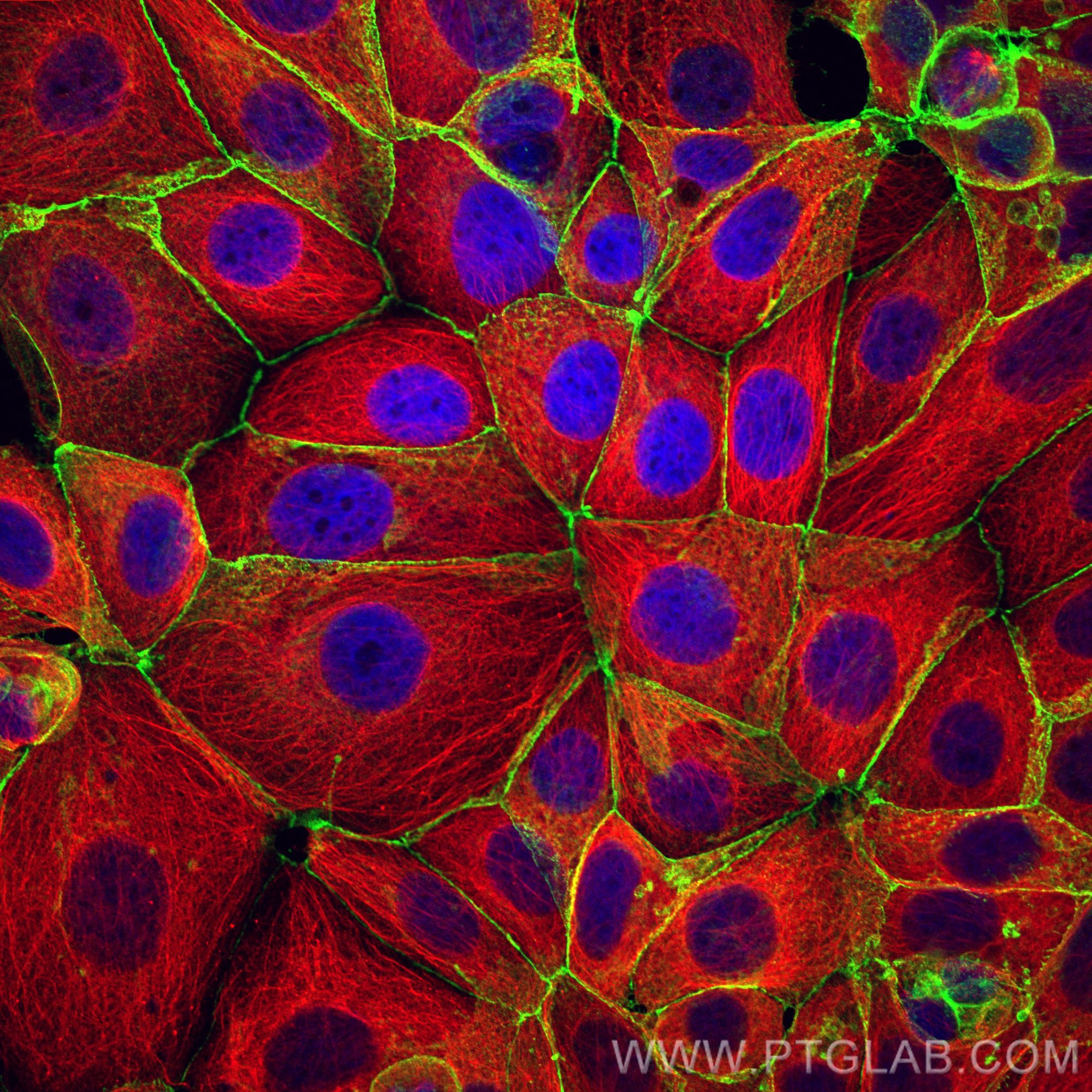 Immunofluorescence (IF) / fluorescent staining of MCF-7 cells using Beta Catenin Recombinant antibody (80488-1-RR)