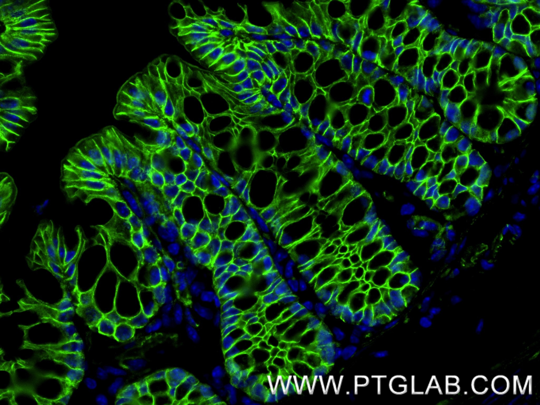 Immunofluorescence (IF) / fluorescent staining of mouse colon tissue using Beta Catenin Recombinant monoclonal antibody (80488-1-RR)