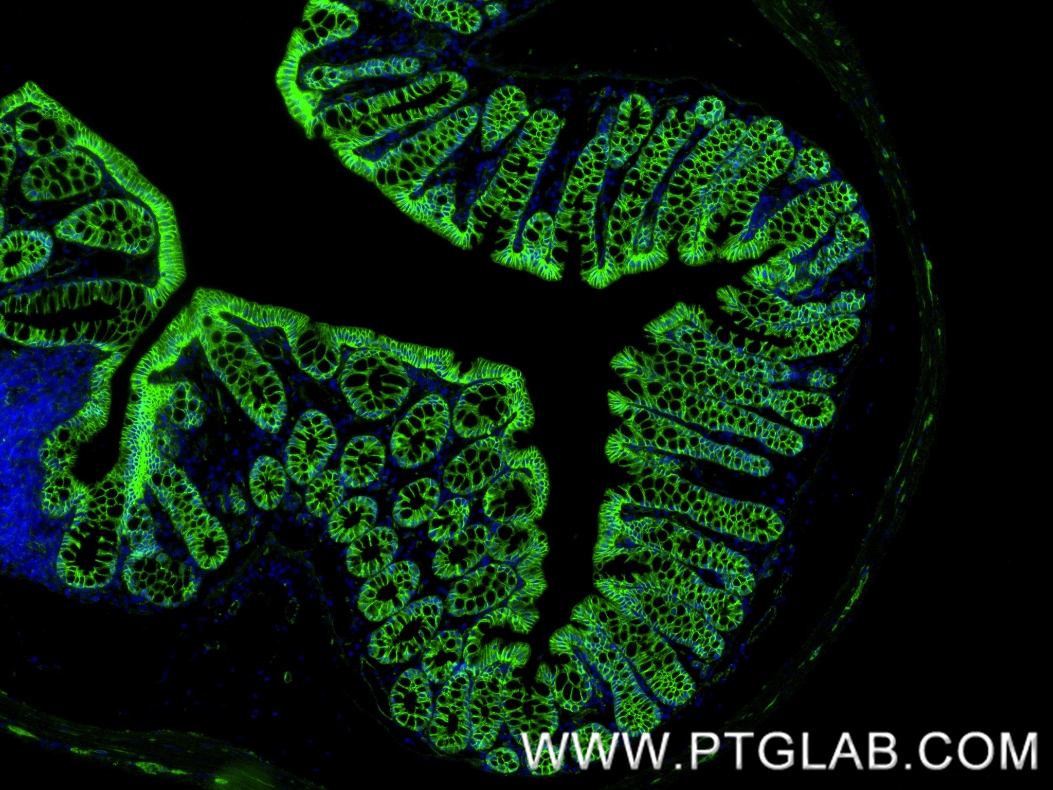 Immunofluorescence (IF) / fluorescent staining of mouse colon tissue using Beta Catenin Recombinant monoclonal antibody (80488-1-RR)