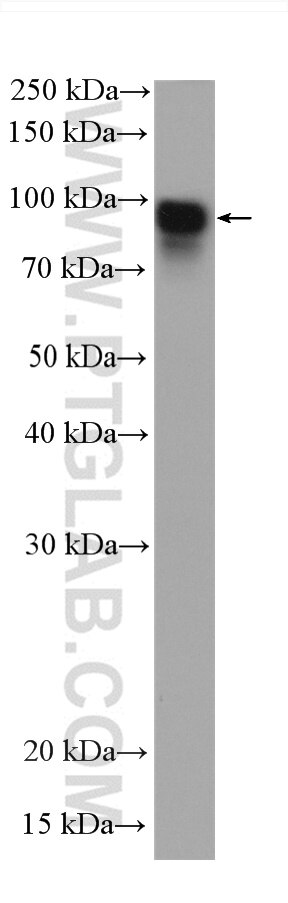 Western Blot (WB) analysis of zebrafish tissue using Beta Catenin Recombinant antibody (80488-1-RR)