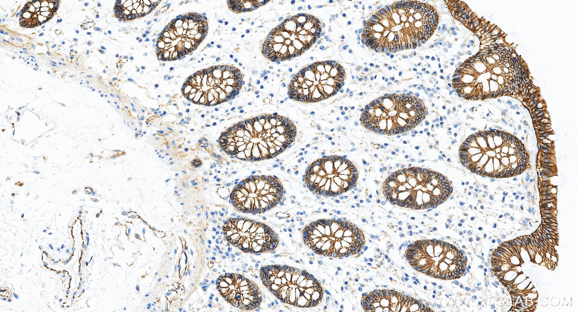 Immunohistochemistry (IHC) staining of human colon tissue using Beta Catenin Recombinant monoclonal antibody (80508-1-RR)