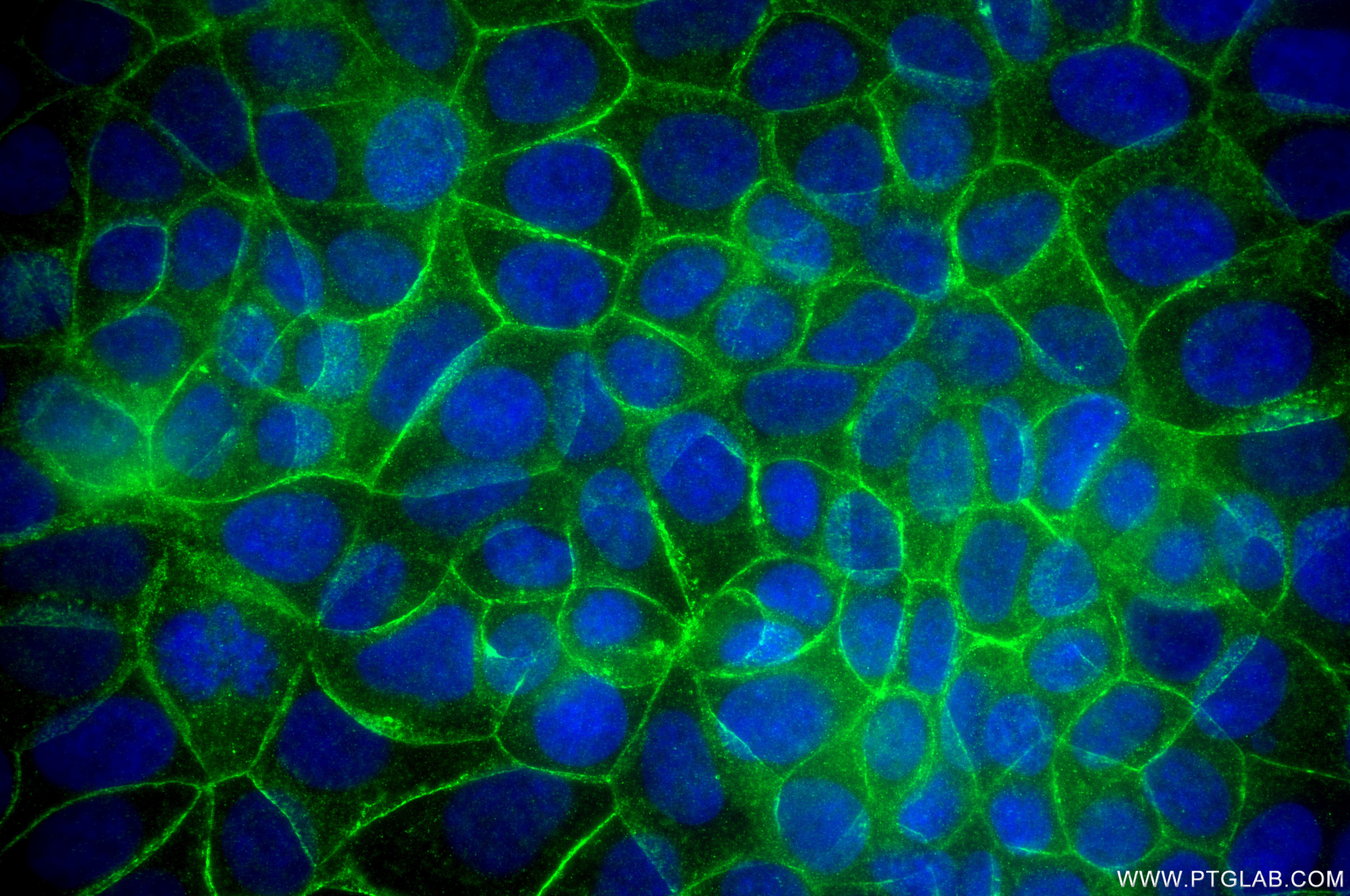 Immunofluorescence (IF) / fluorescent staining of MCF-7 cells using Beta Catenin Recombinant monoclonal antibody (80508-1-RR)
