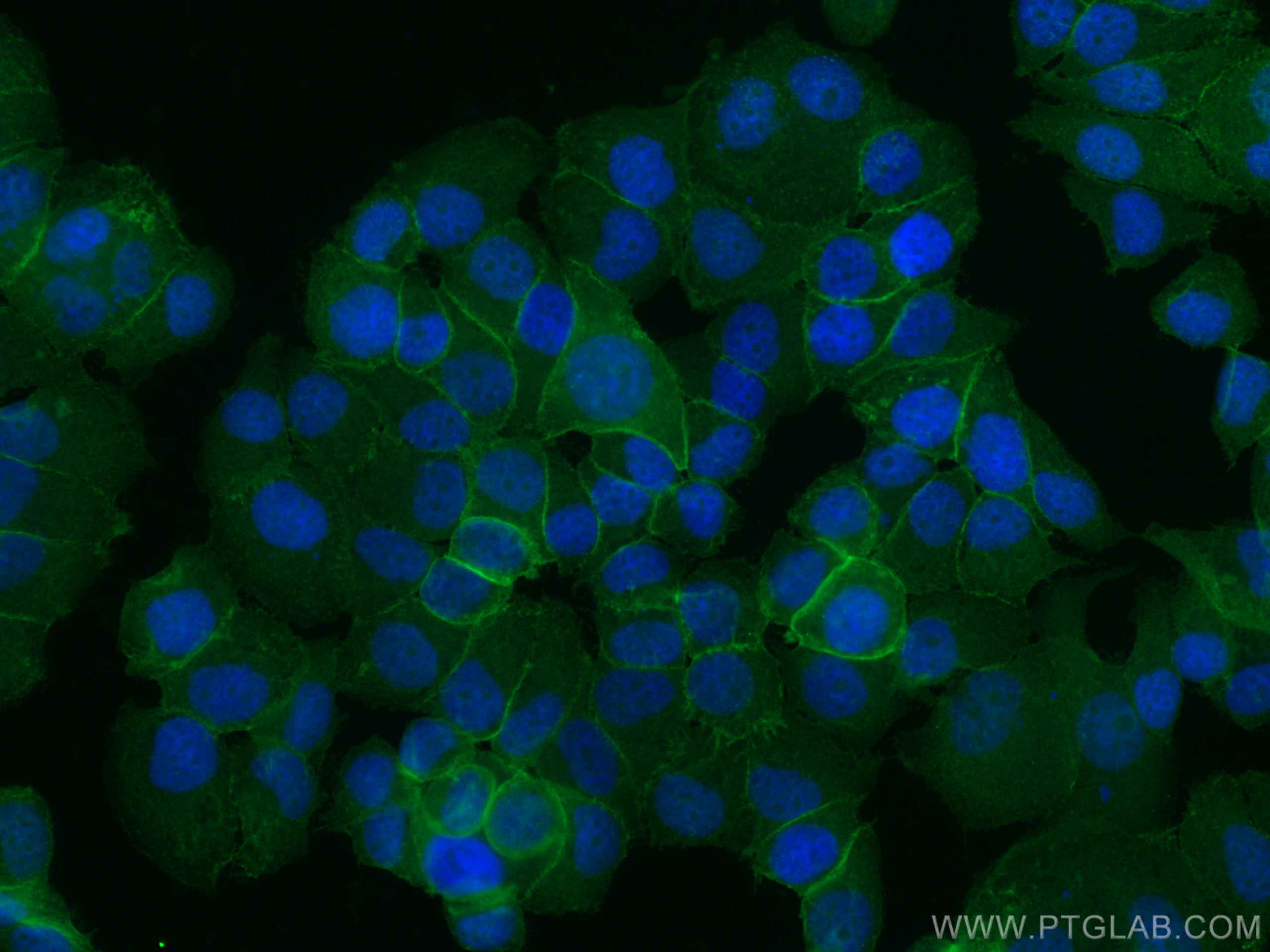 Immunofluorescence (IF) / fluorescent staining of T-47D cells using CoraLite® Plus 488-conjugated Beta Catenin Polyclo (CL488-17565)