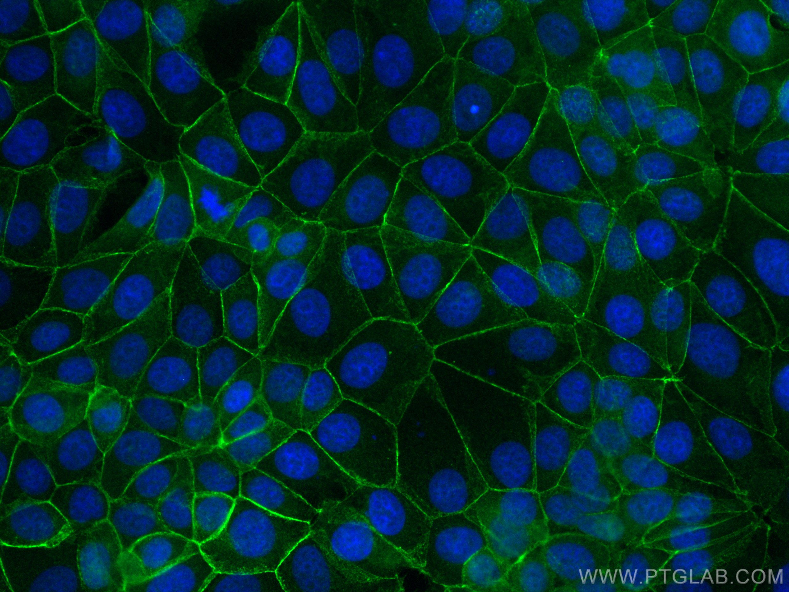Immunofluorescence (IF) / fluorescent staining of MCF-7 cells using CoraLite® Plus 488-conjugated Beta Catenin Polyclo (CL488-17565)