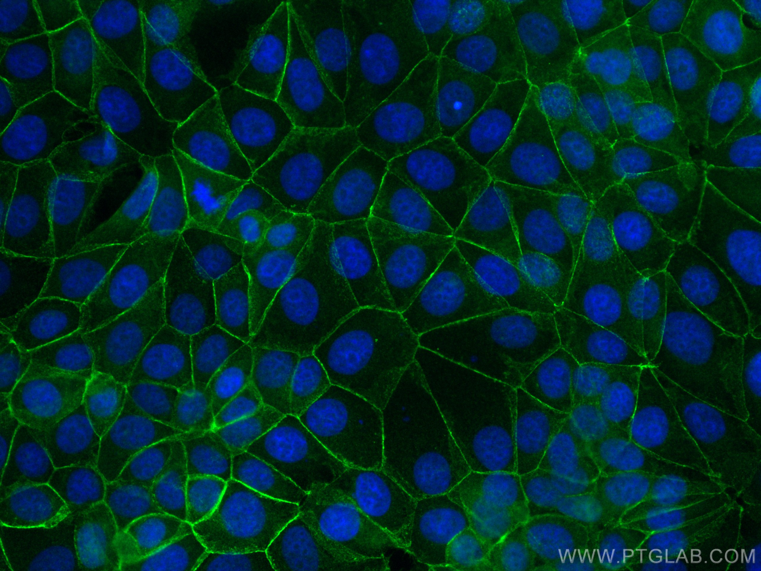 IF Staining of MCF-7 using CL488-17565