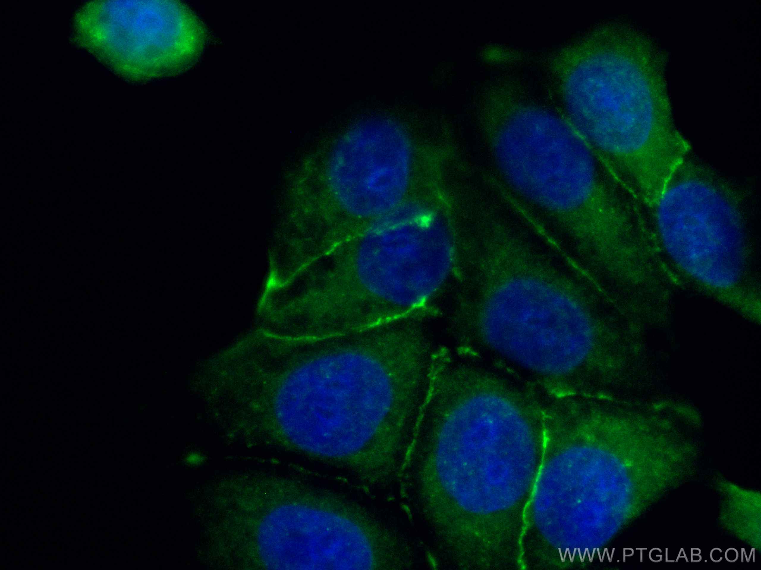 Immunofluorescence (IF) / fluorescent staining of MCF-7 cells using CoraLite® Plus 488-conjugated Beta Catenin Polyclo (CL488-51067)