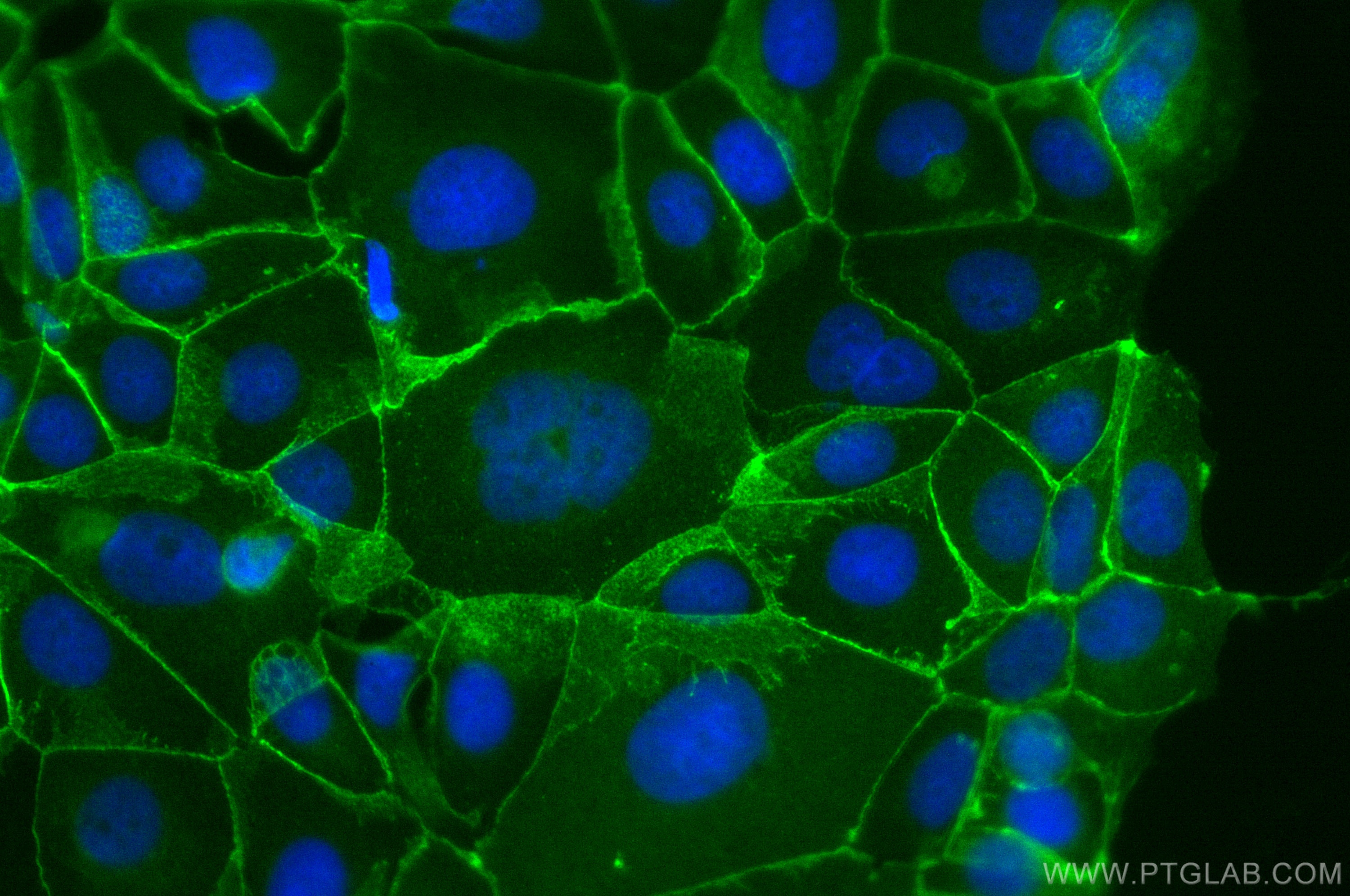 Immunofluorescence (IF) / fluorescent staining of MCF-7 cells using CoraLite® Plus 488-conjugated Beta Catenin Polyclo (CL488-51067)