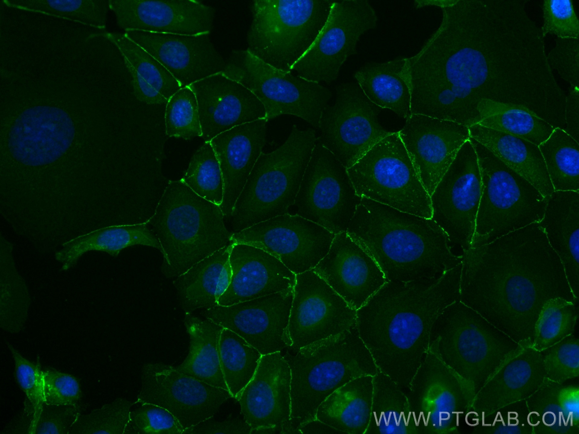 IF Staining of MCF-7 using CL488-80488