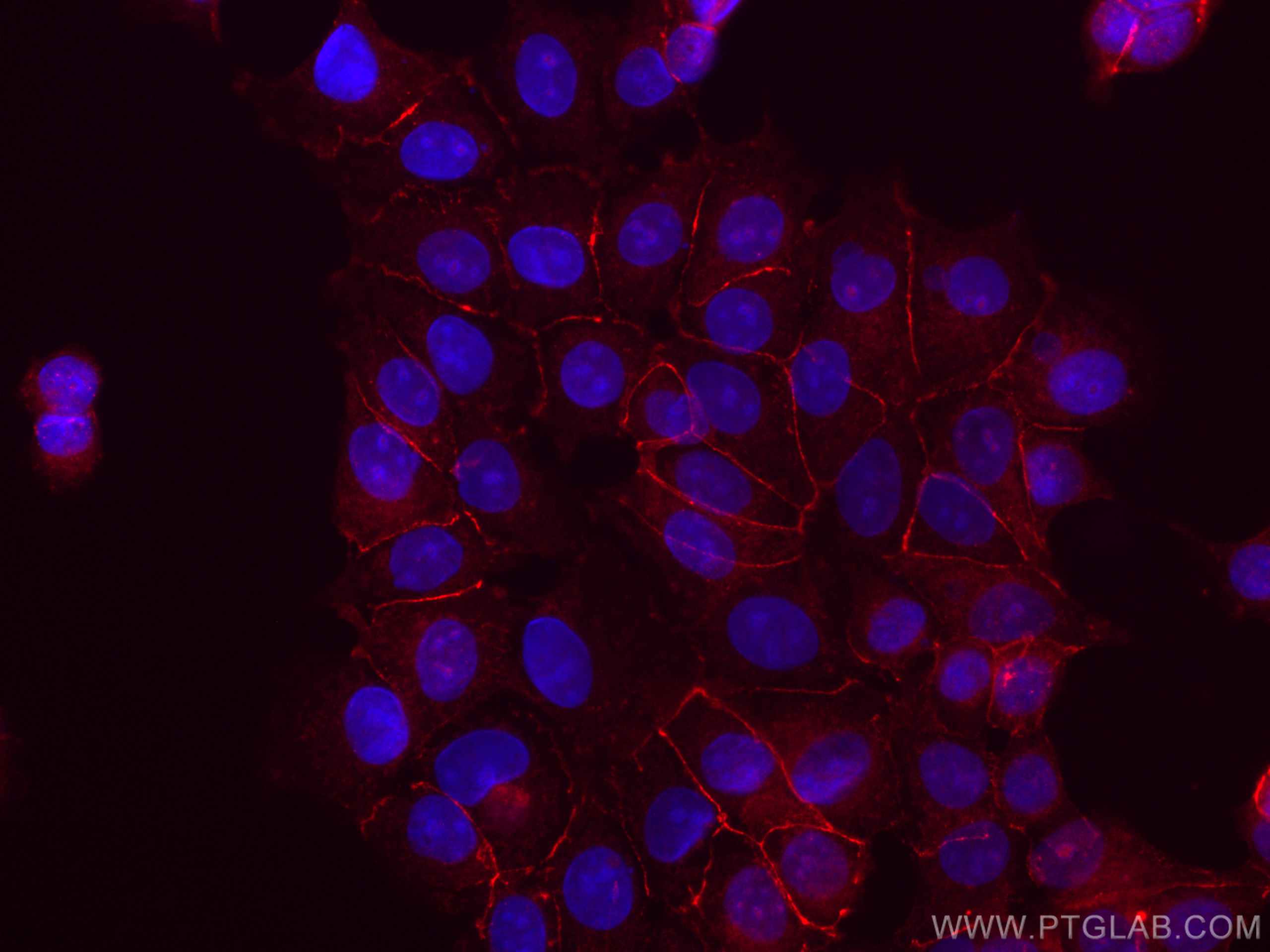Immunofluorescence (IF) / fluorescent staining of MCF-7 cells using CoraLite®555-conjugated Beta Catenin Polyclonal an (CL555-51067)