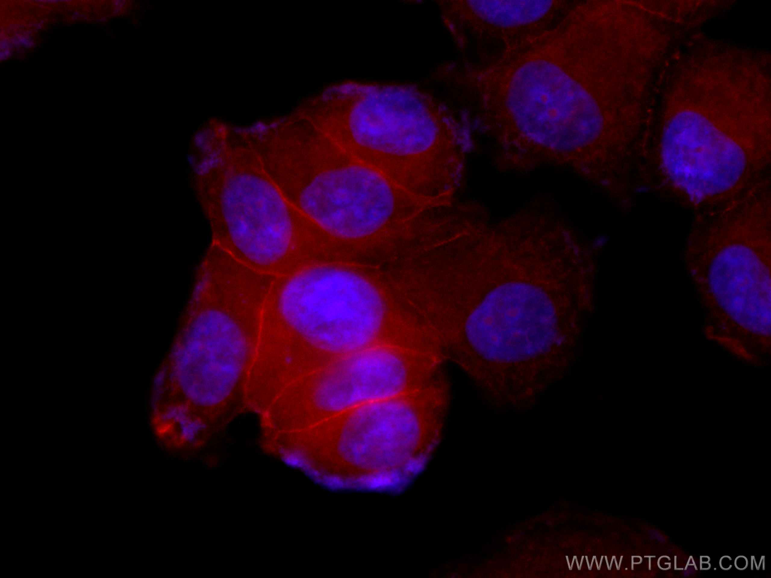 Immunofluorescence (IF) / fluorescent staining of T-47D cells using CoraLite®594-conjugated Beta Catenin Polyclonal an (CL594-17565)