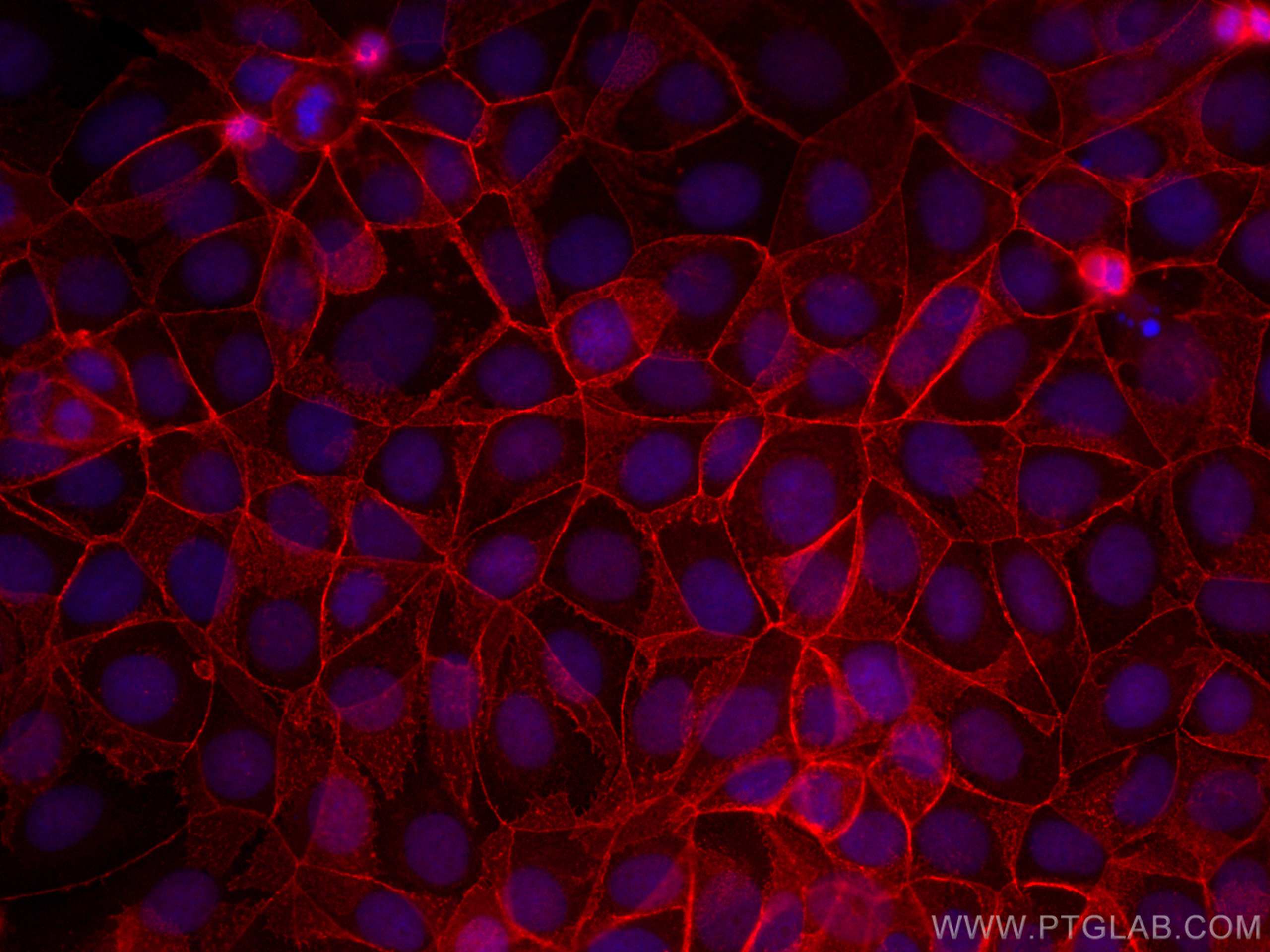 Immunofluorescence (IF) / fluorescent staining of MCF-7 cells using CoraLite®594-conjugated Beta Catenin Polyclonal an (CL594-17565)