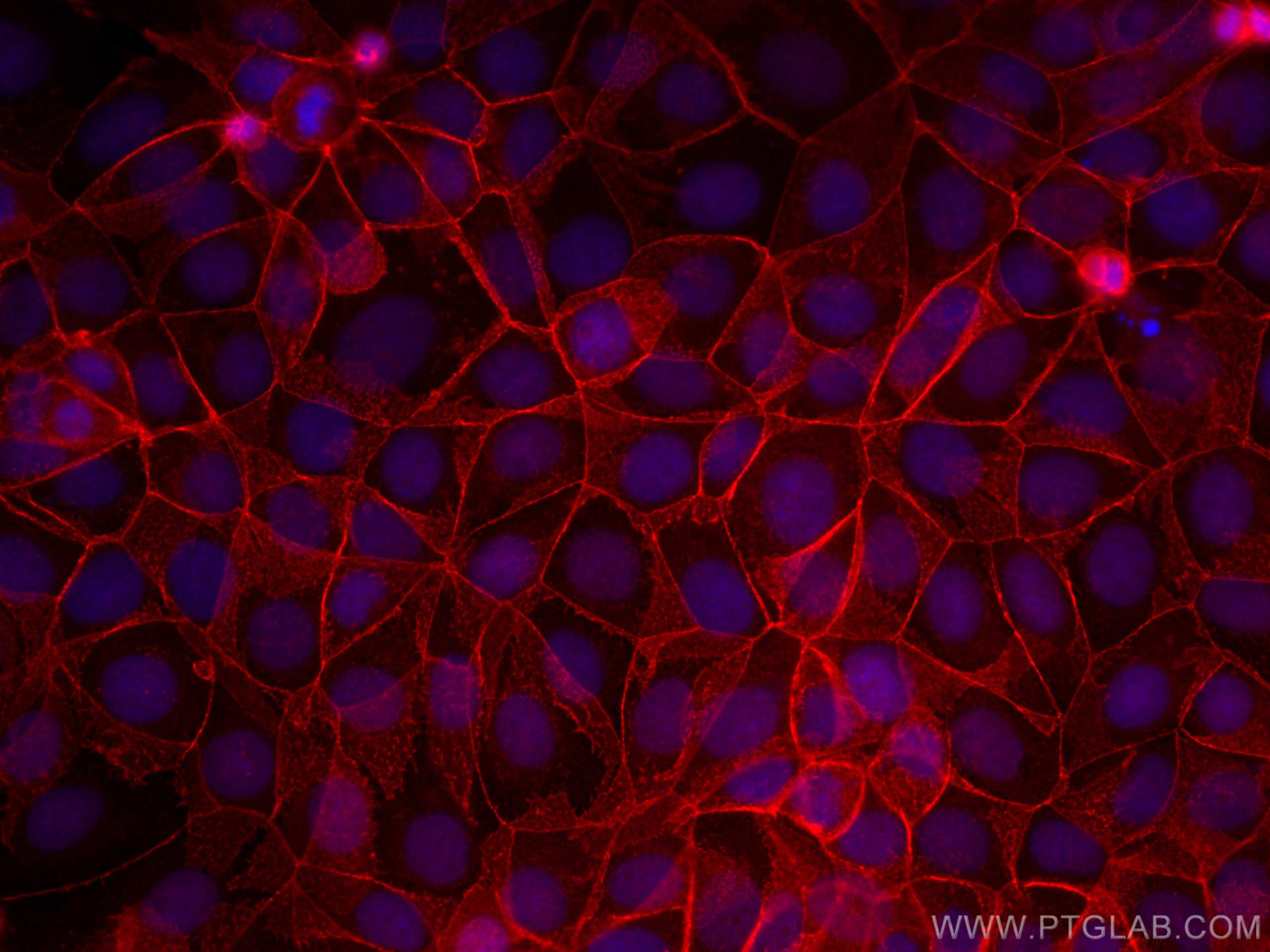 IF Staining of MCF-7 using CL594-17565