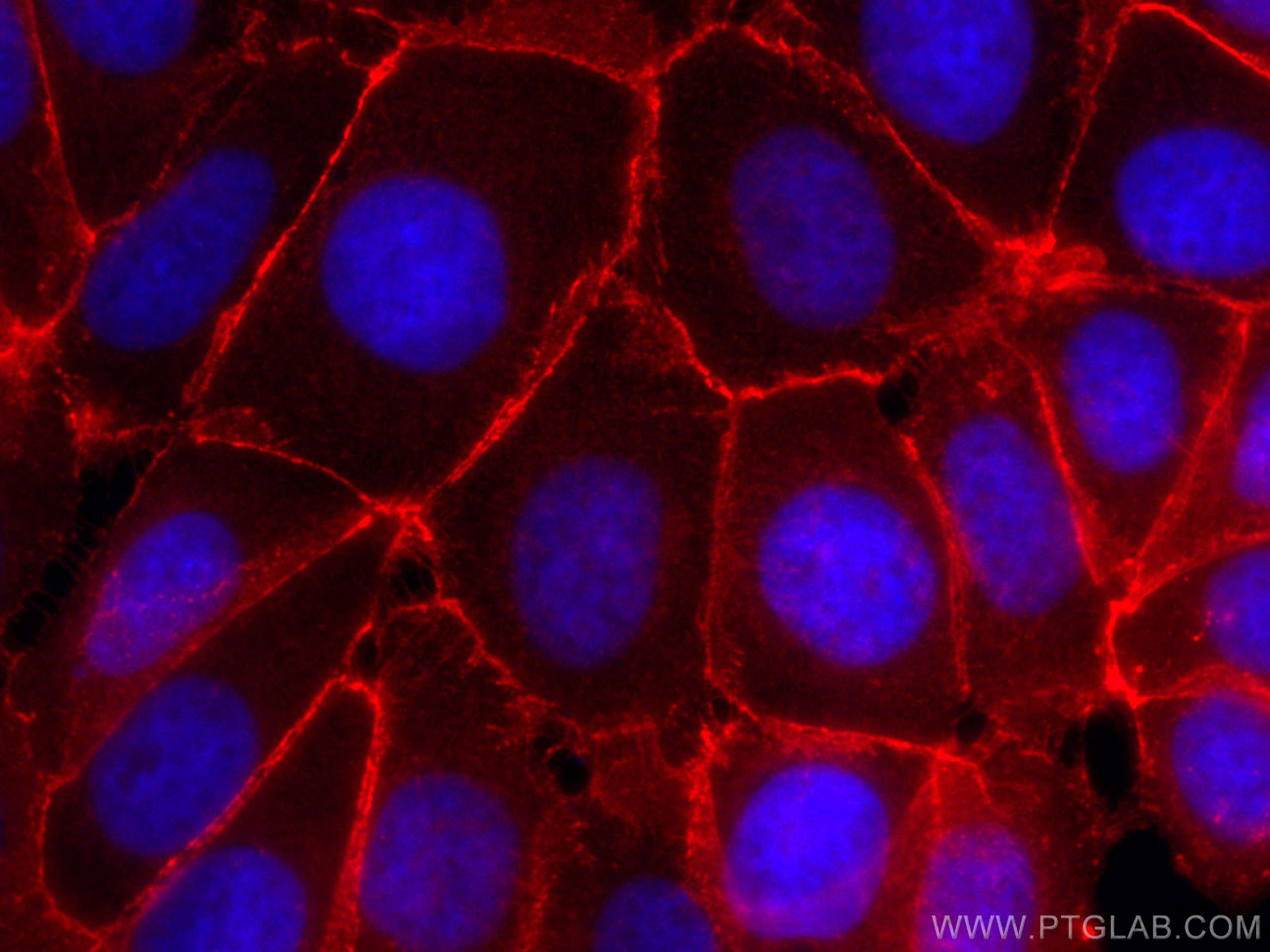 Immunofluorescence (IF) / fluorescent staining of MCF-7 cells using CoraLite®594-conjugated Beta Catenin Polyclonal an (CL594-17565)