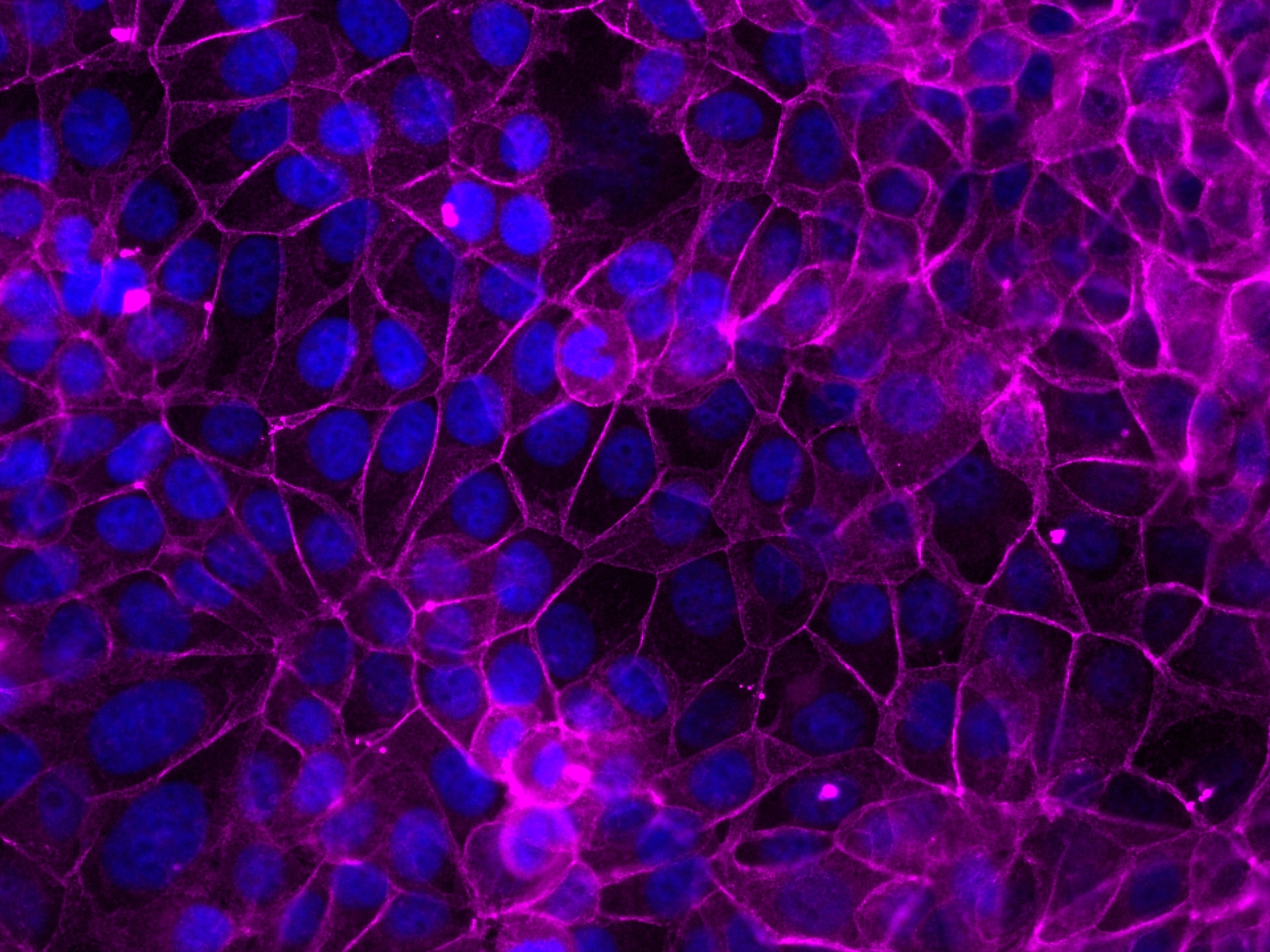 Immunofluorescence (IF) / fluorescent staining of MCF-7 cells using CoraLite® Plus 647-conjugated Beta Catenin Polyclo (CL647-51067)