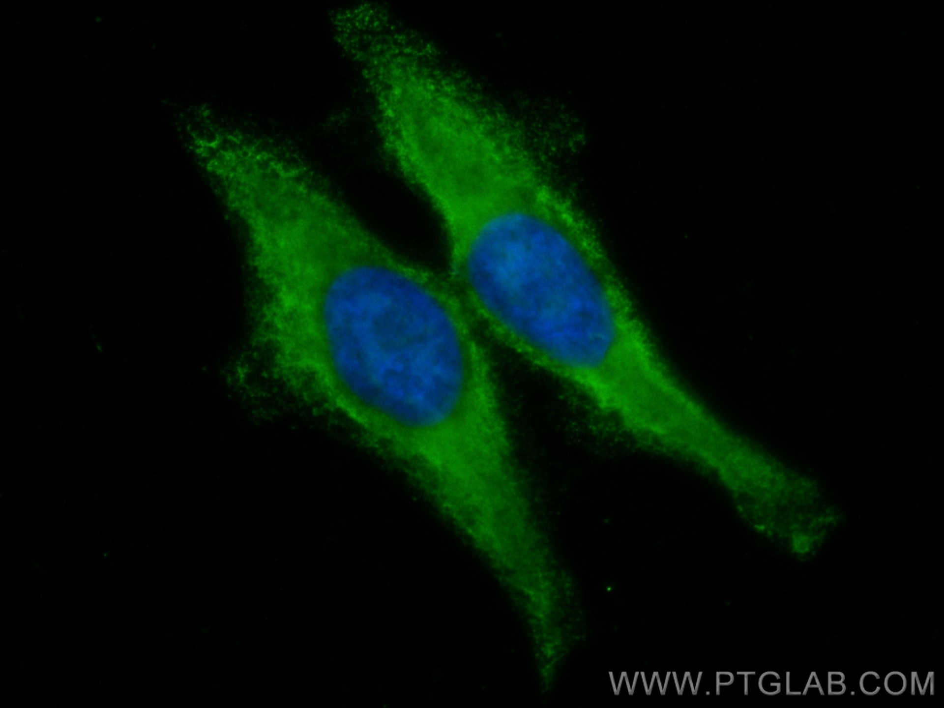 Immunofluorescence (IF) / fluorescent staining of HepG2 cells using CoraLite® Plus 488-conjugated Beta Galactosidase M (CL488-66586)