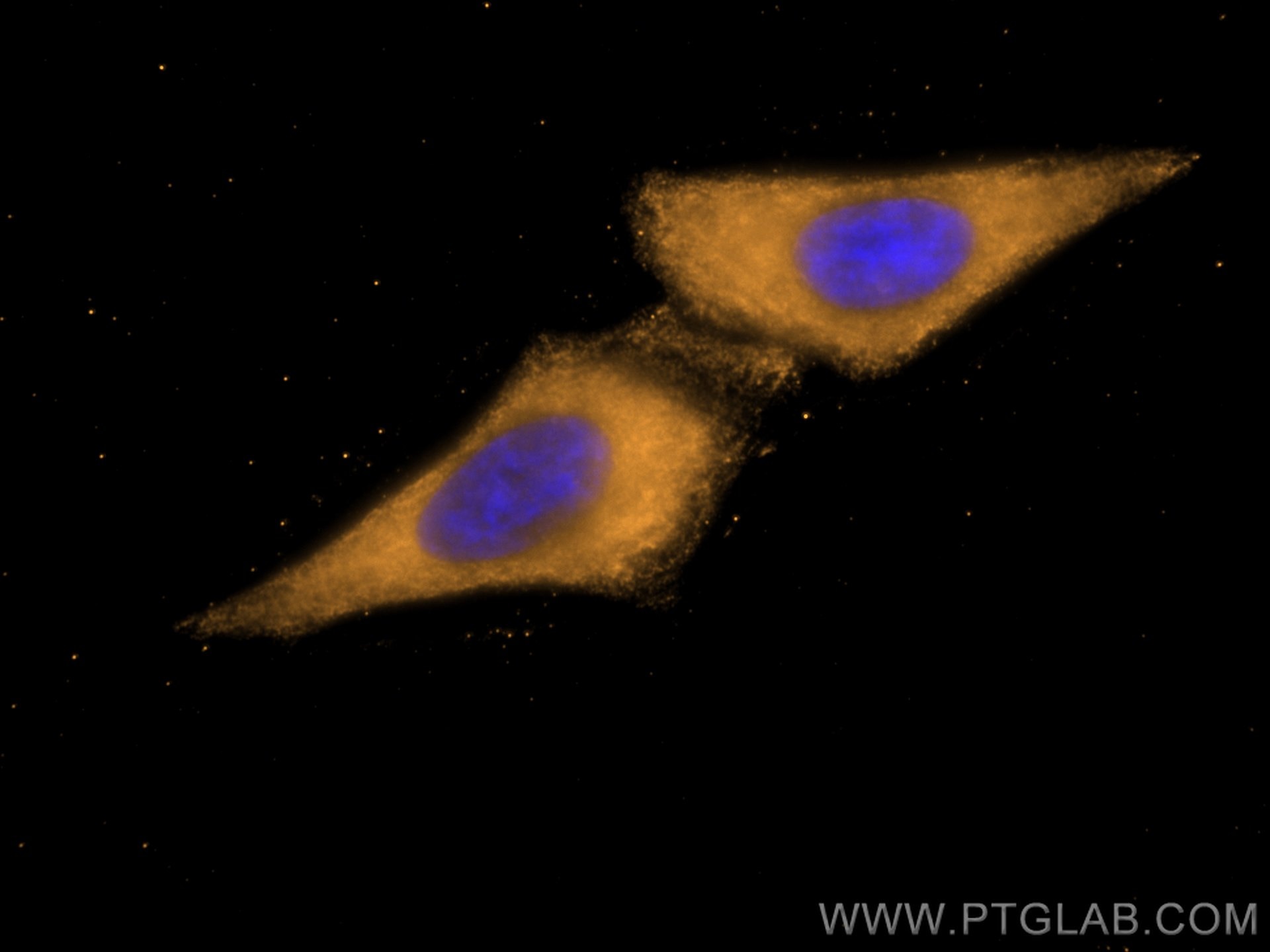 Immunofluorescence (IF) / fluorescent staining of HepG2 cells using CoraLite®555-conjugated Beta Galactosidase Monoclo (CL555-66586)