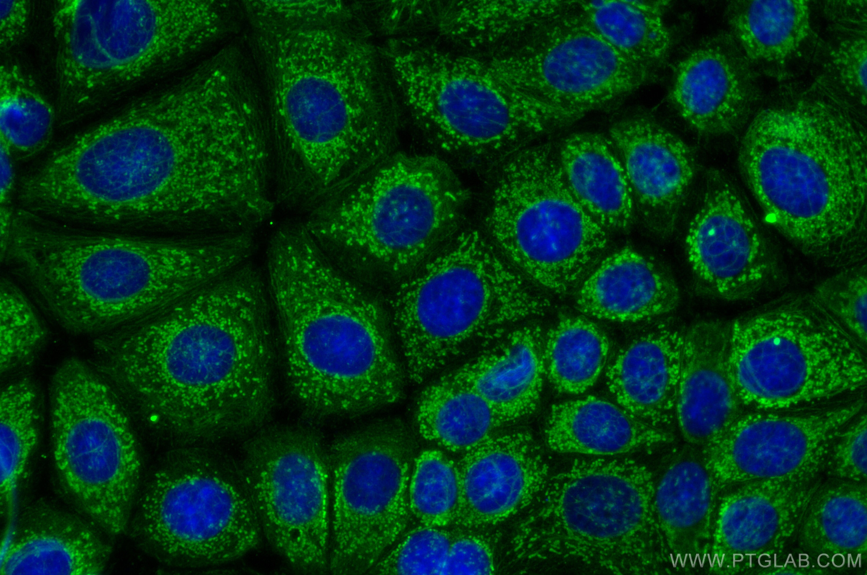 Immunofluorescence (IF) / fluorescent staining of MCF-7 cells using Beta TRCP Polyclonal antibody (28393-1-AP)