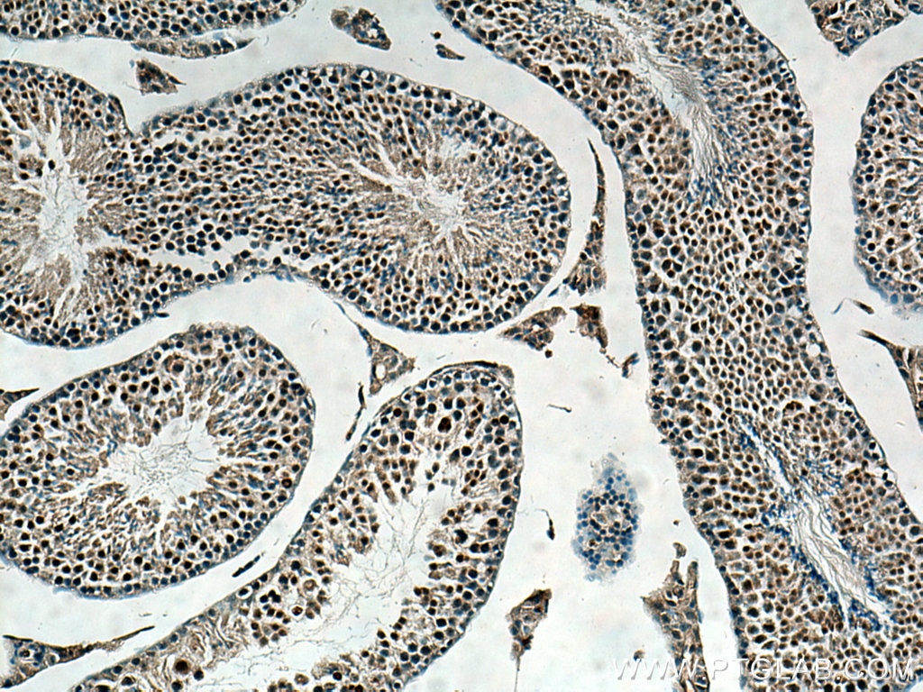 Immunohistochemistry (IHC) staining of mouse testis tissue using Beta TRCP Polyclonal antibody (28393-1-AP)