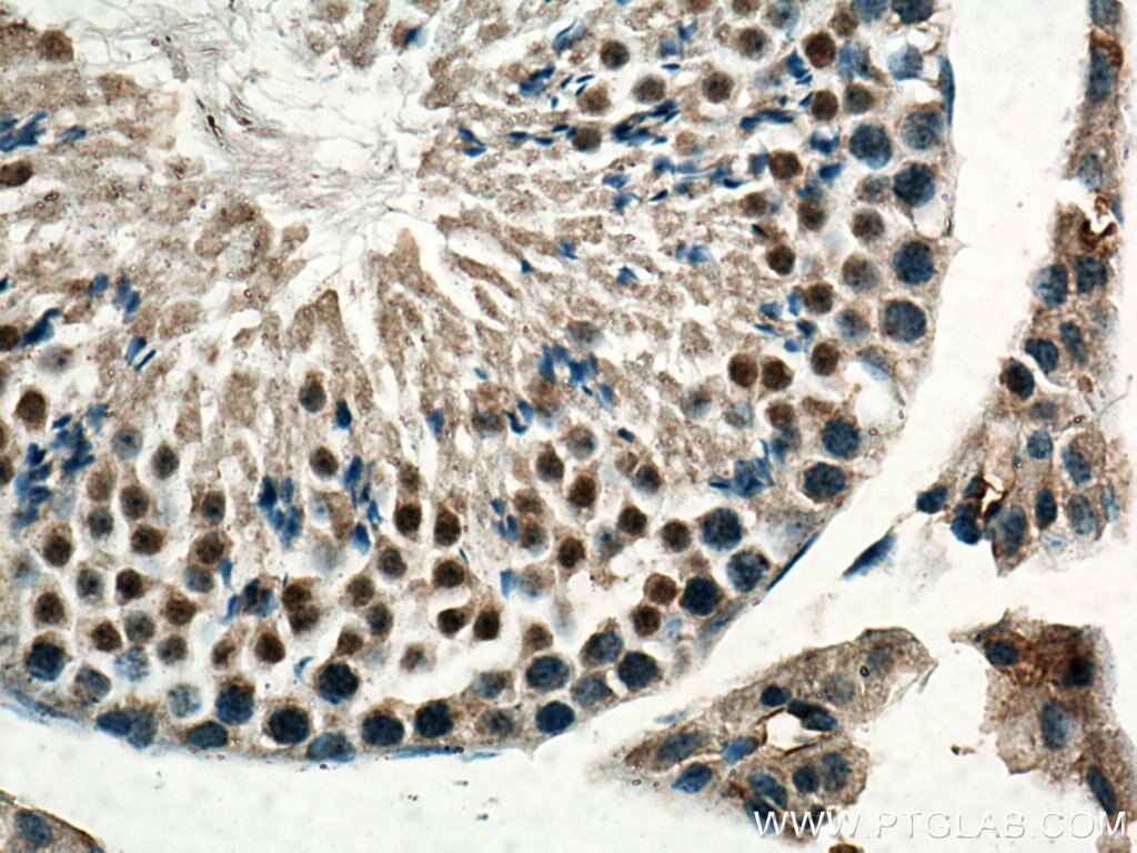 Immunohistochemistry (IHC) staining of mouse testis tissue using Beta TRCP Polyclonal antibody (28393-1-AP)
